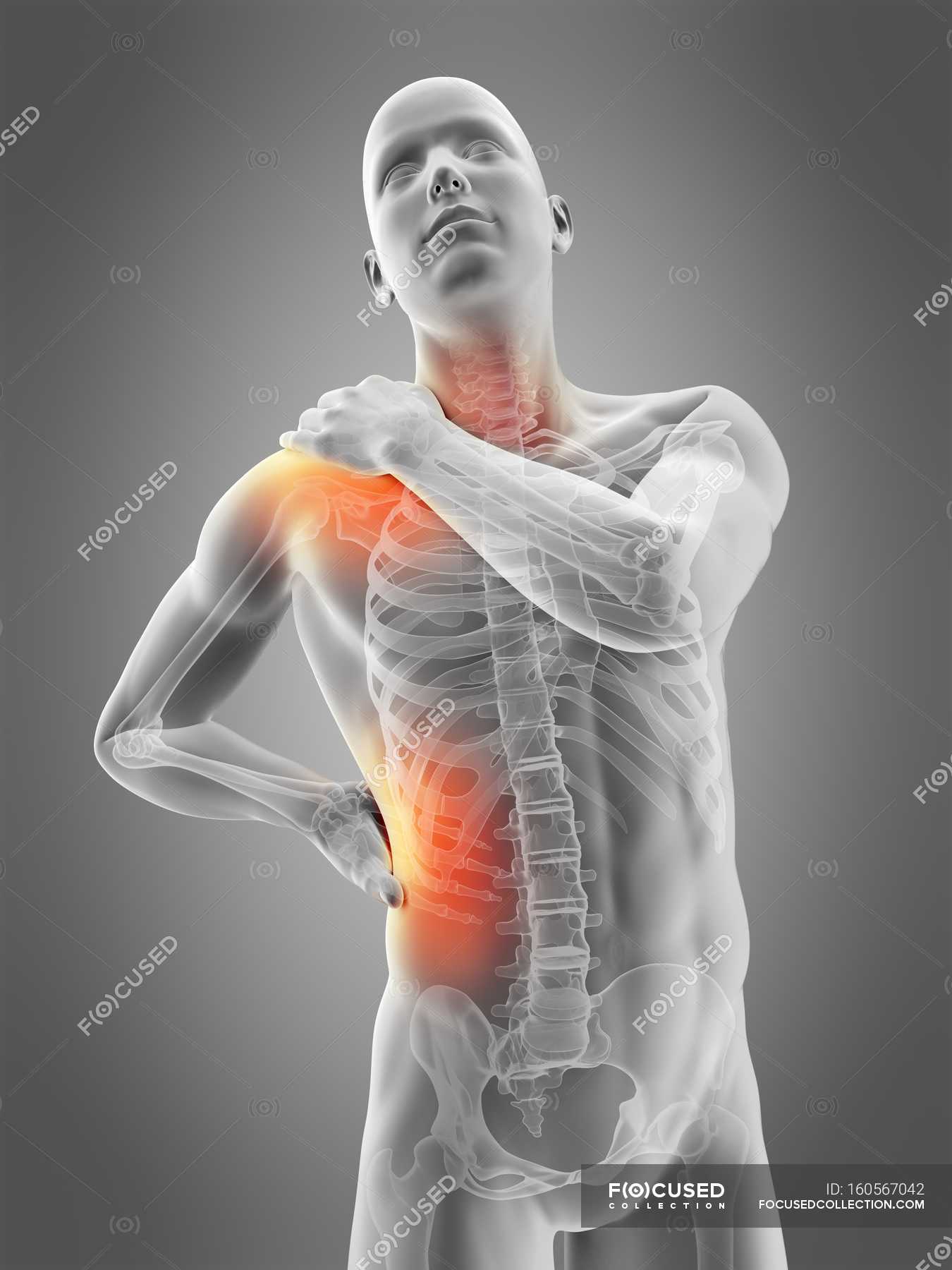 Shoulder and waist pain localization — view, Digitally Generated ...