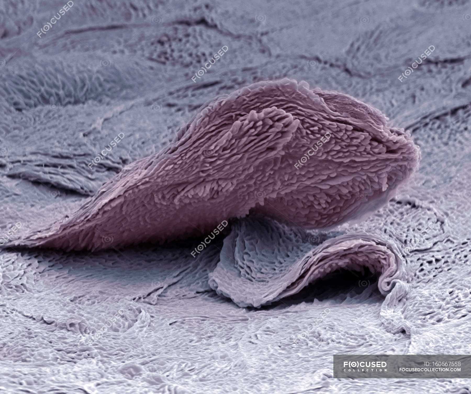 Роговой слой кожи под микроскопом
