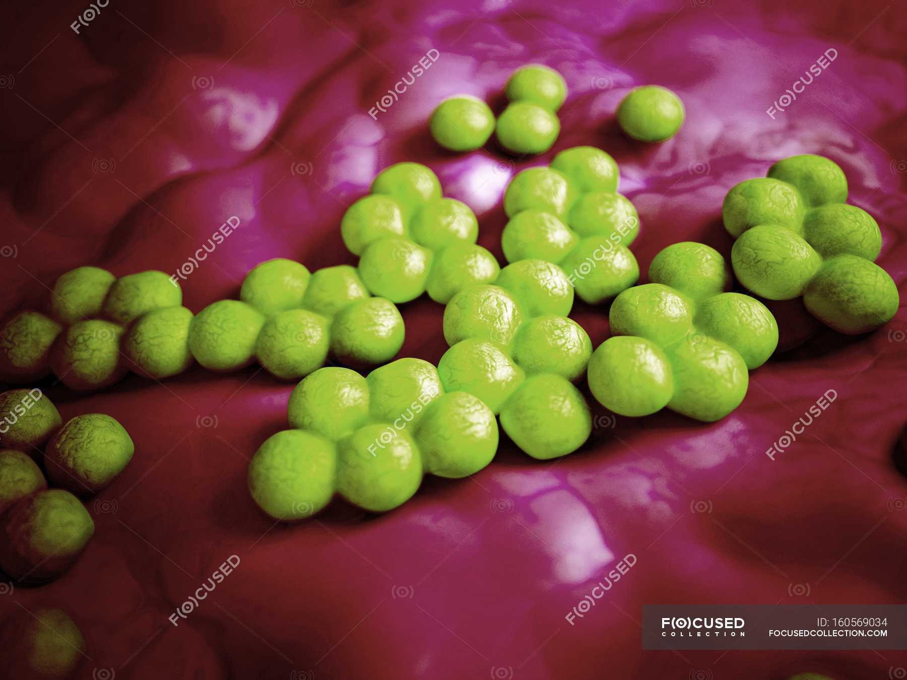 Staphylococcus Aureus Causing Sore Throat