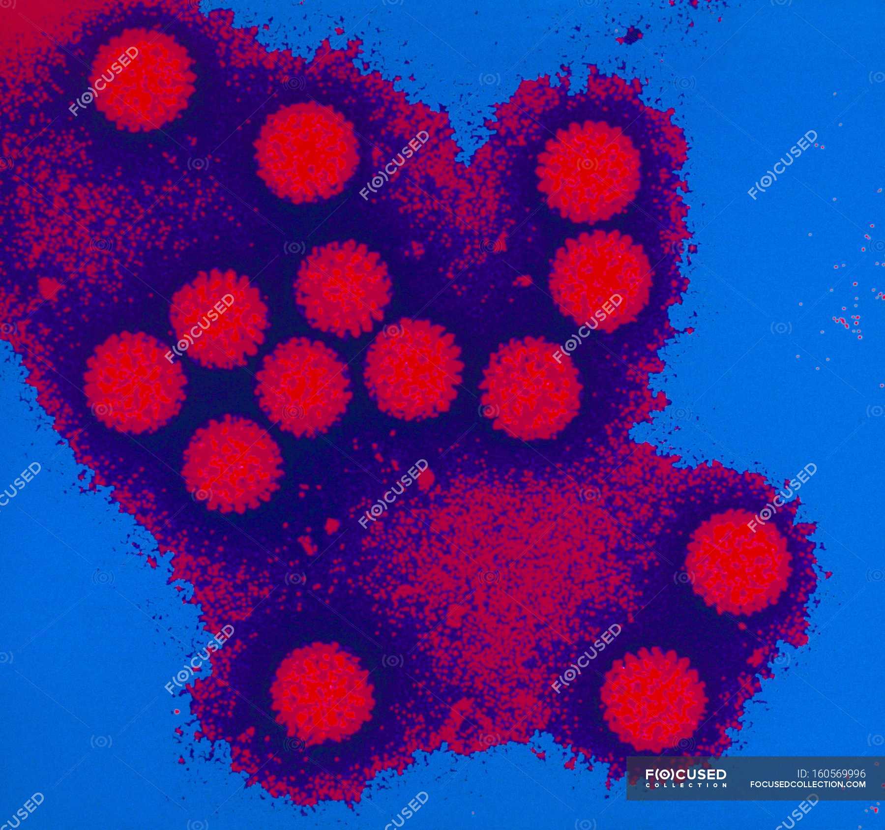 инфекционные агенты. жидкий агент в биологии\. вирусы грибы простейшие. вирусные агенты. возбудитель коронавирус микробиология.