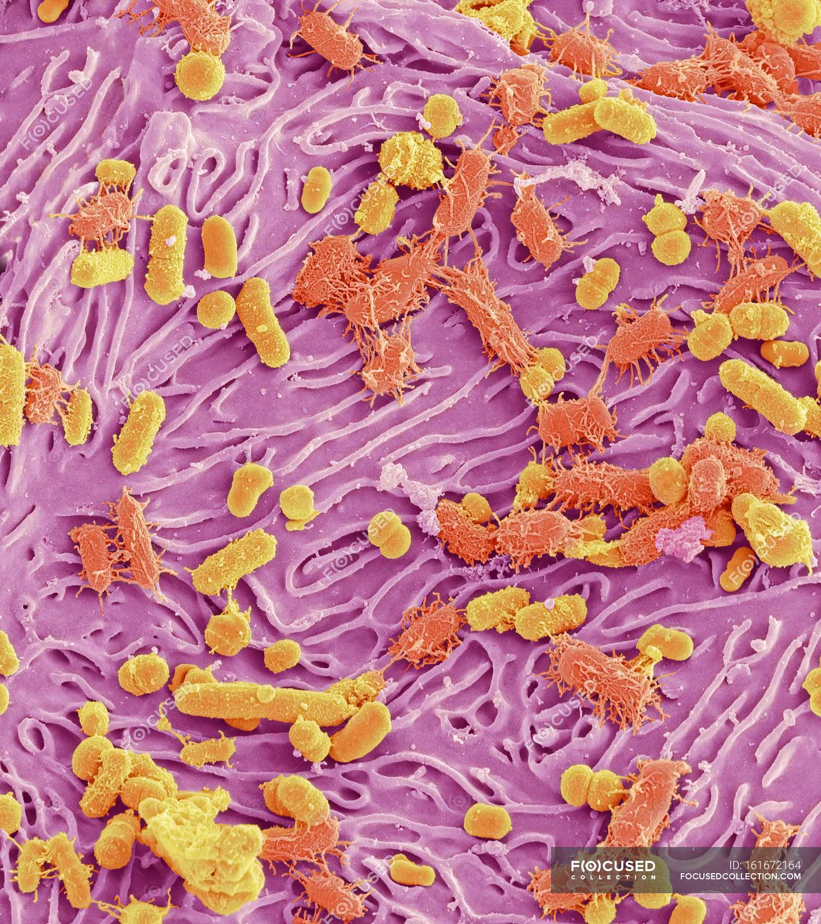 Бактерии в слюне. Бактерии Streptococcus Mutans кариес. Бактерии под микроскопом. Микроорганизмы под микроскопом. Микробы полости рта под микроскопом.