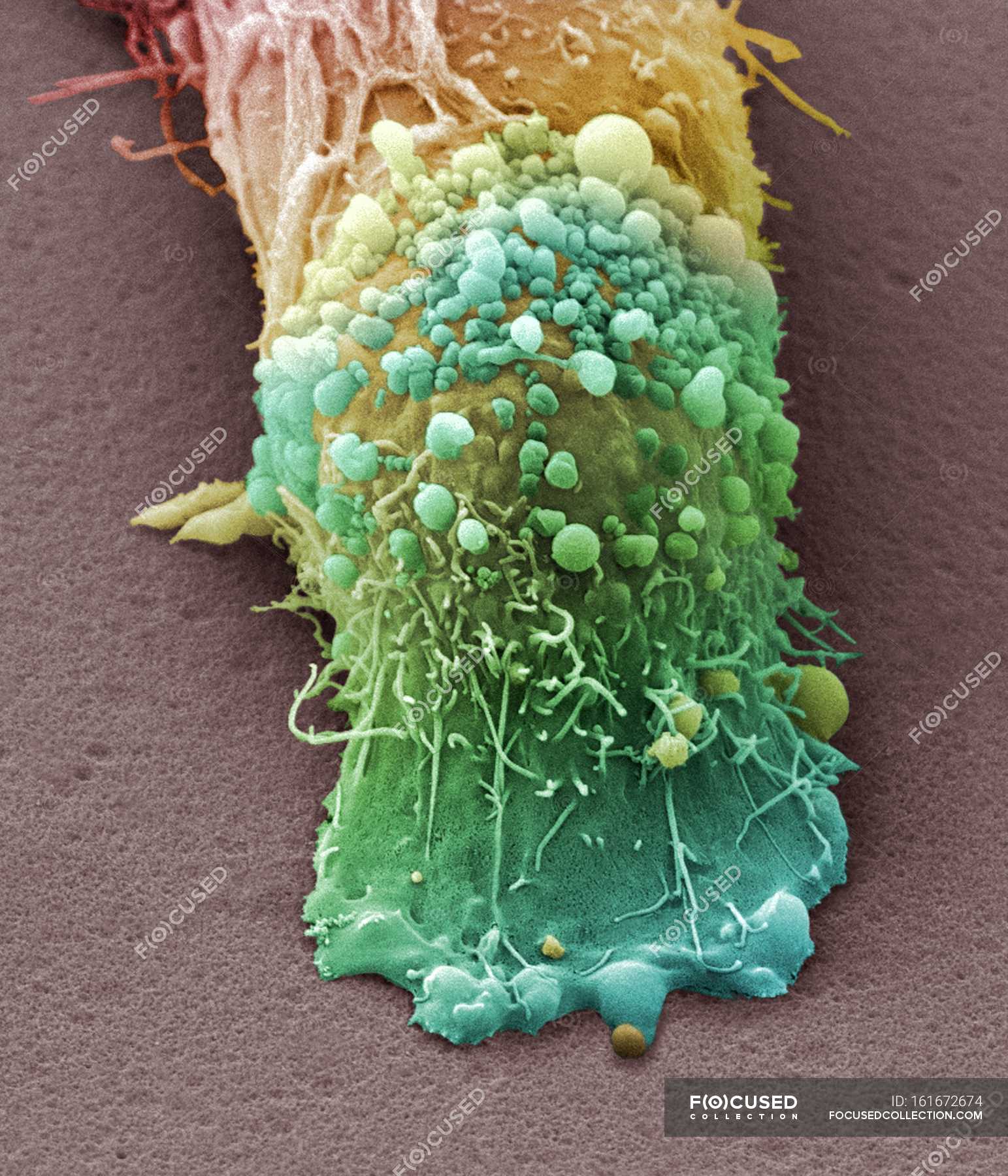 Skin cancer cell — melanocytes, numerous Stock Photo 161672674