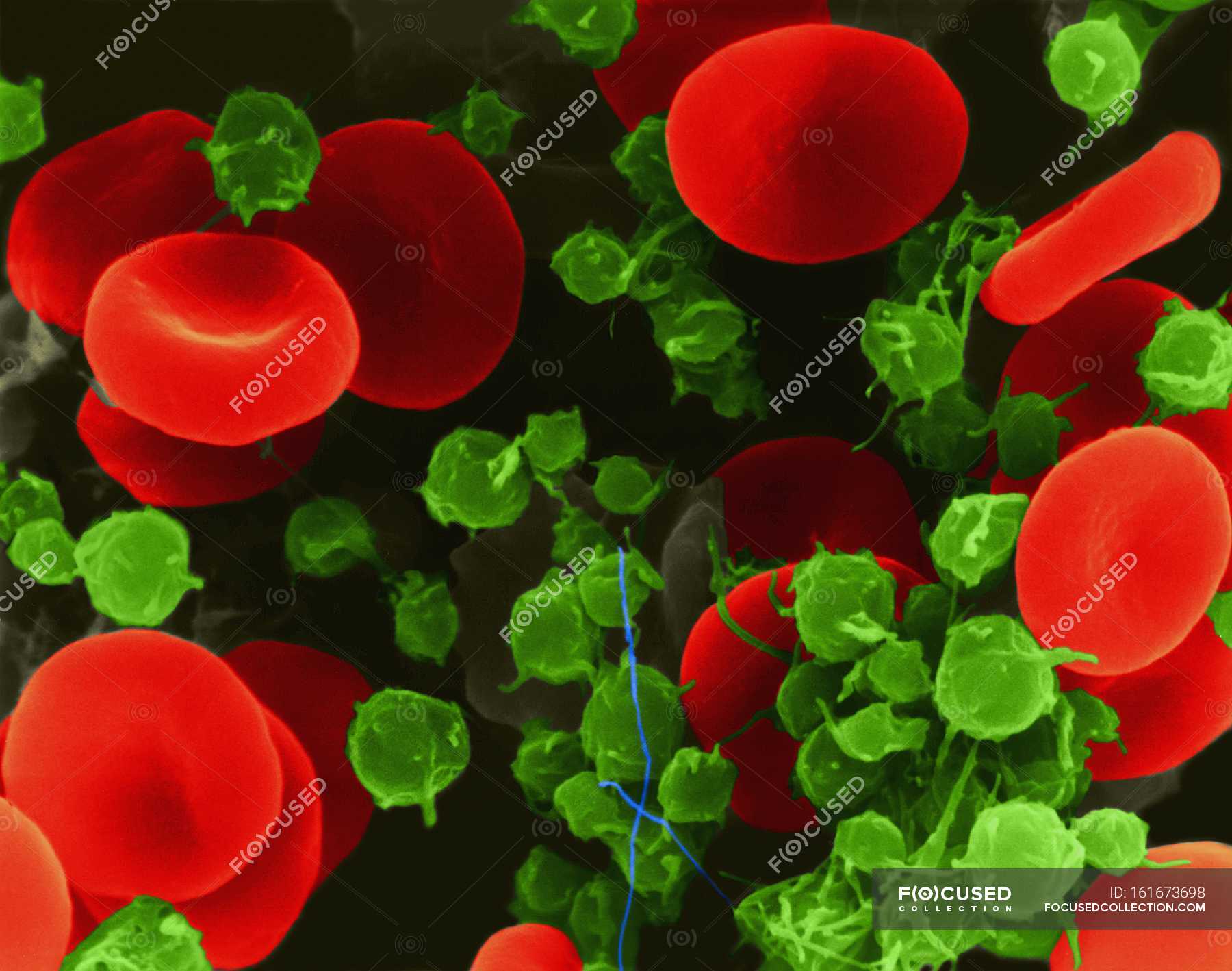 Human red blood cells and platelets — coloured, medical illustration