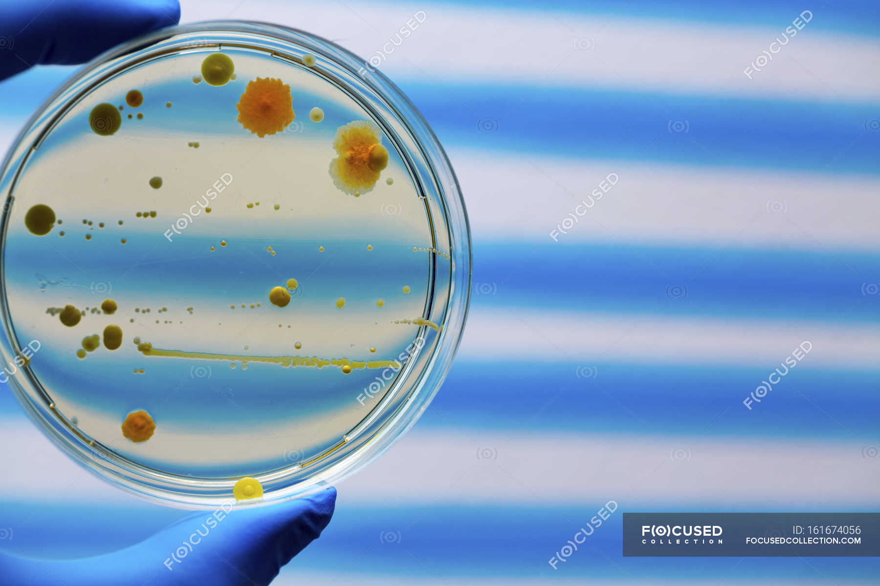 Страва Петрі з бактеріями — просте тло, синій фон - Stock Photo ...