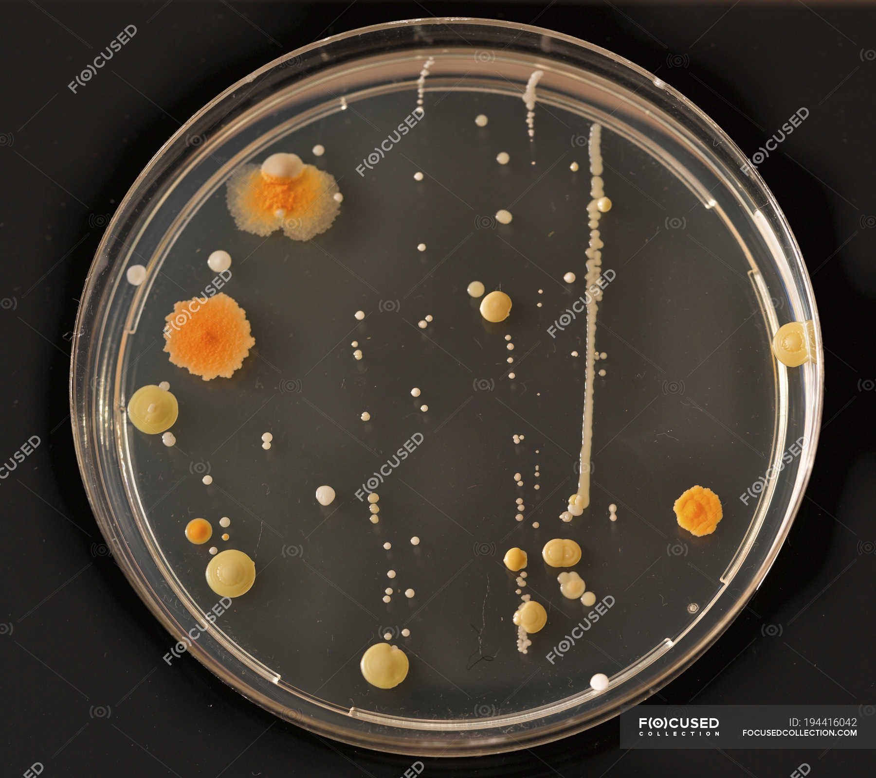 Эксперимент с чашкой петри. Палочка Коха в чашке Петри. Mycobacterium на чашке Петри. ОМЧ чашка Петри 30 колоний. Mycobacterium tuberculosis на чашке Петри.