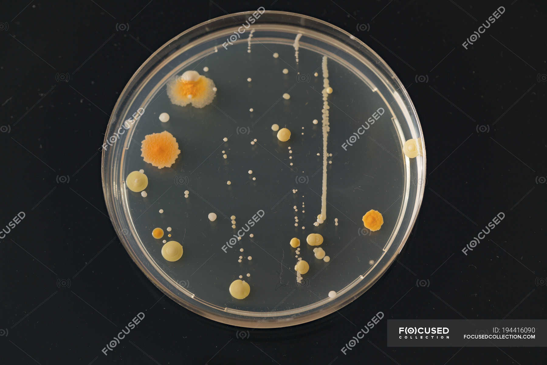 Microbiological culture growing in Petri dish. — top view, laboratory