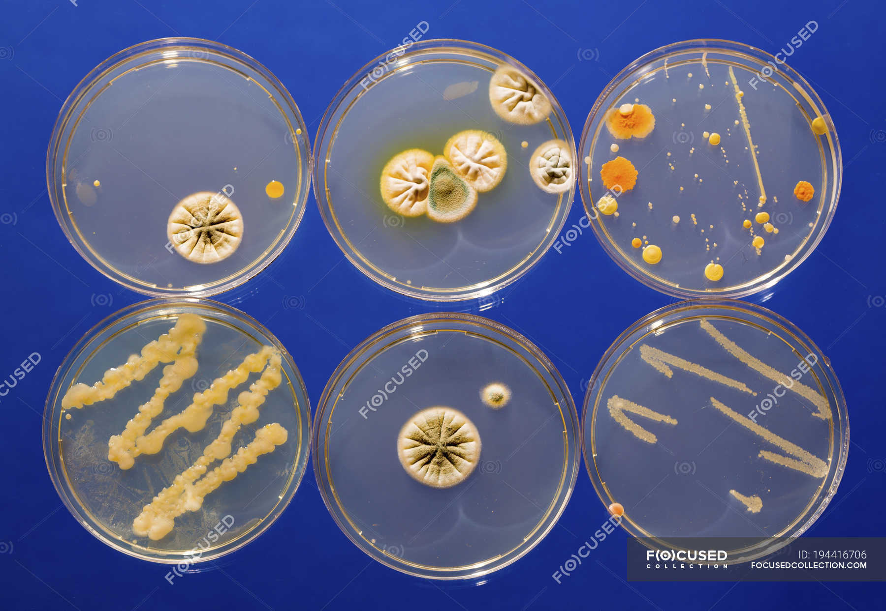 Microbiological Cultures Growing In Petri Dishes Growth Analysis 