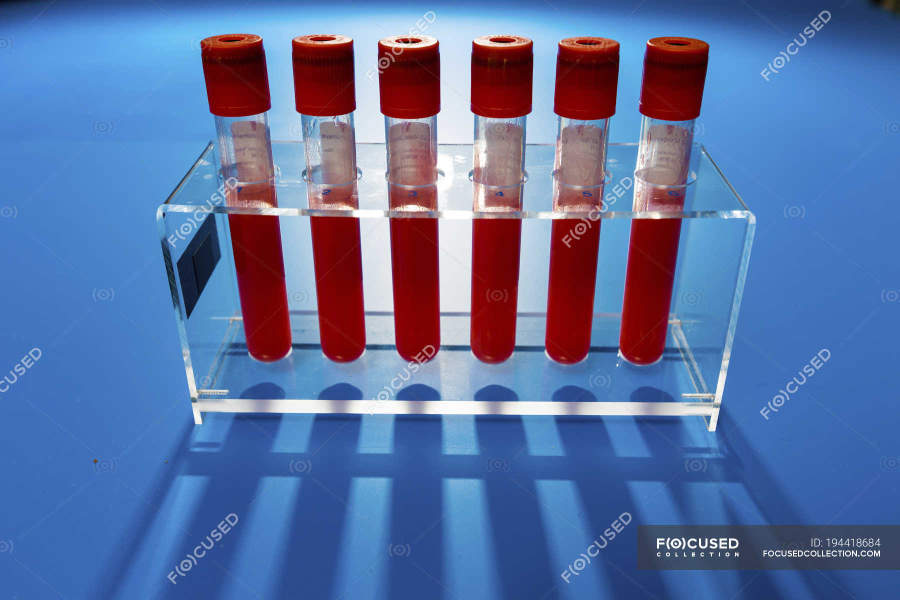 Rack of test tubes with blood samples on blue background. — health