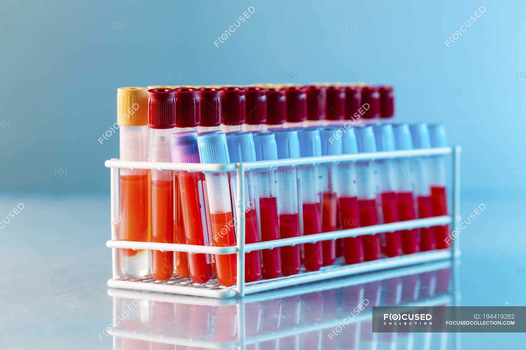 Rack of test tubes with blood samples in laboratory. — haematological
