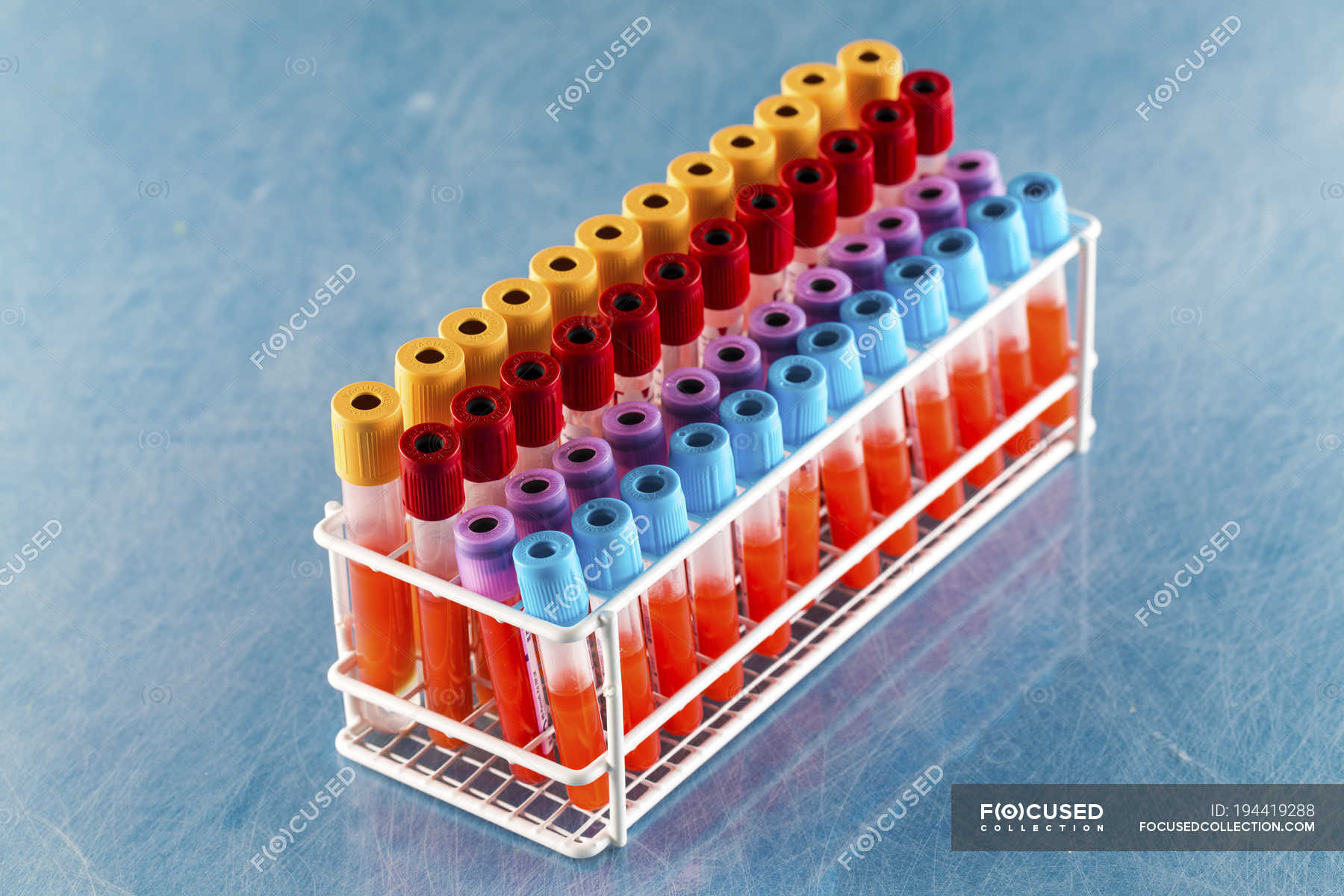 Rack of test tubes with blood samples in laboratory. — haematology