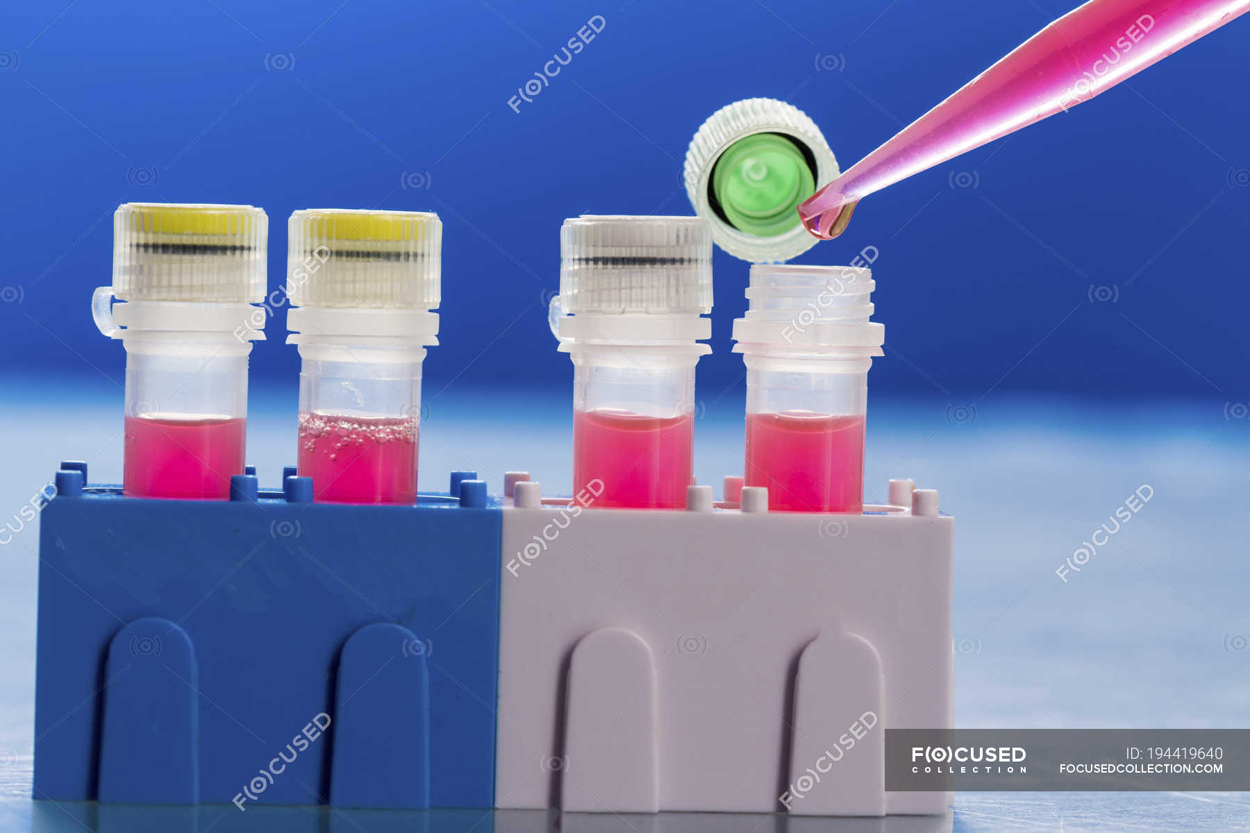 Closeup of pipette pipetting into test tubes in pathogenic laboratory