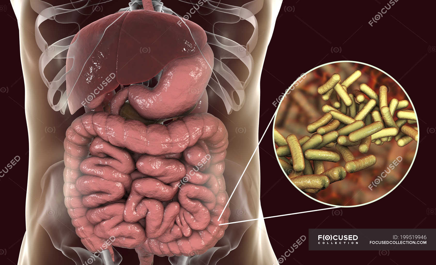 Human digestive system with Shigellosis infection and close-up of Shigella bacteria. — gram ...
