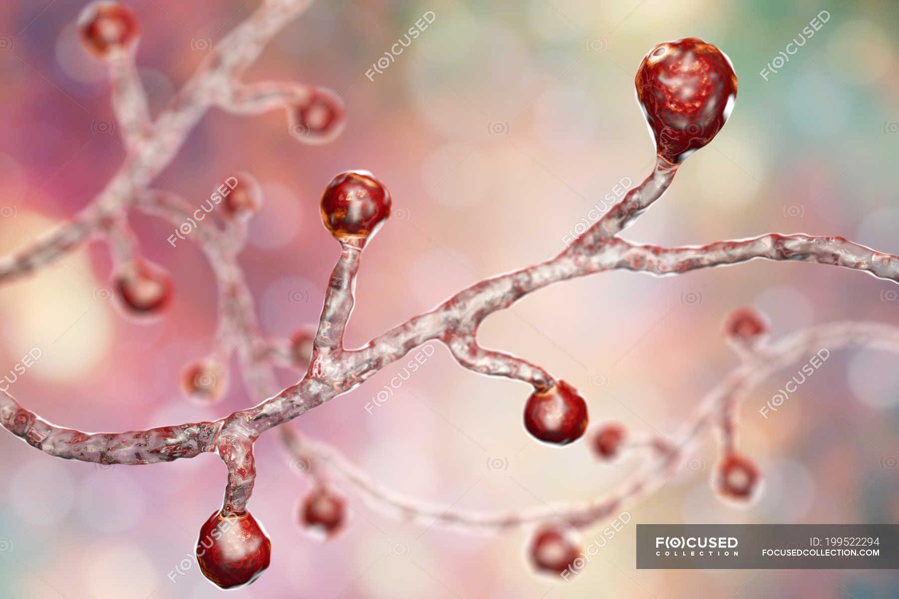 Colored Digital Illustration Of Blastomyces Dermatitidis Fungus Causing Fungal Infection 