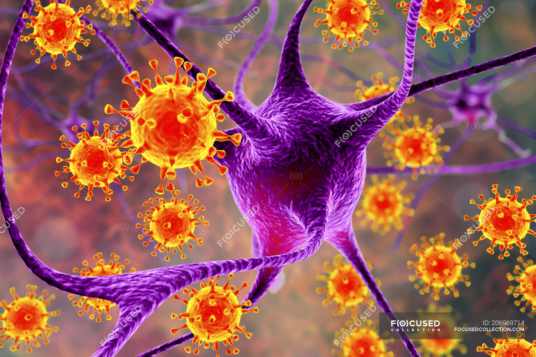 Conceptual illustration showing virus infecting neurons of brain ...