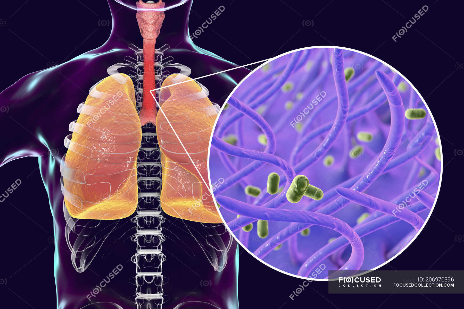 Whooping cough contagious infectious lungs disease and closeup of