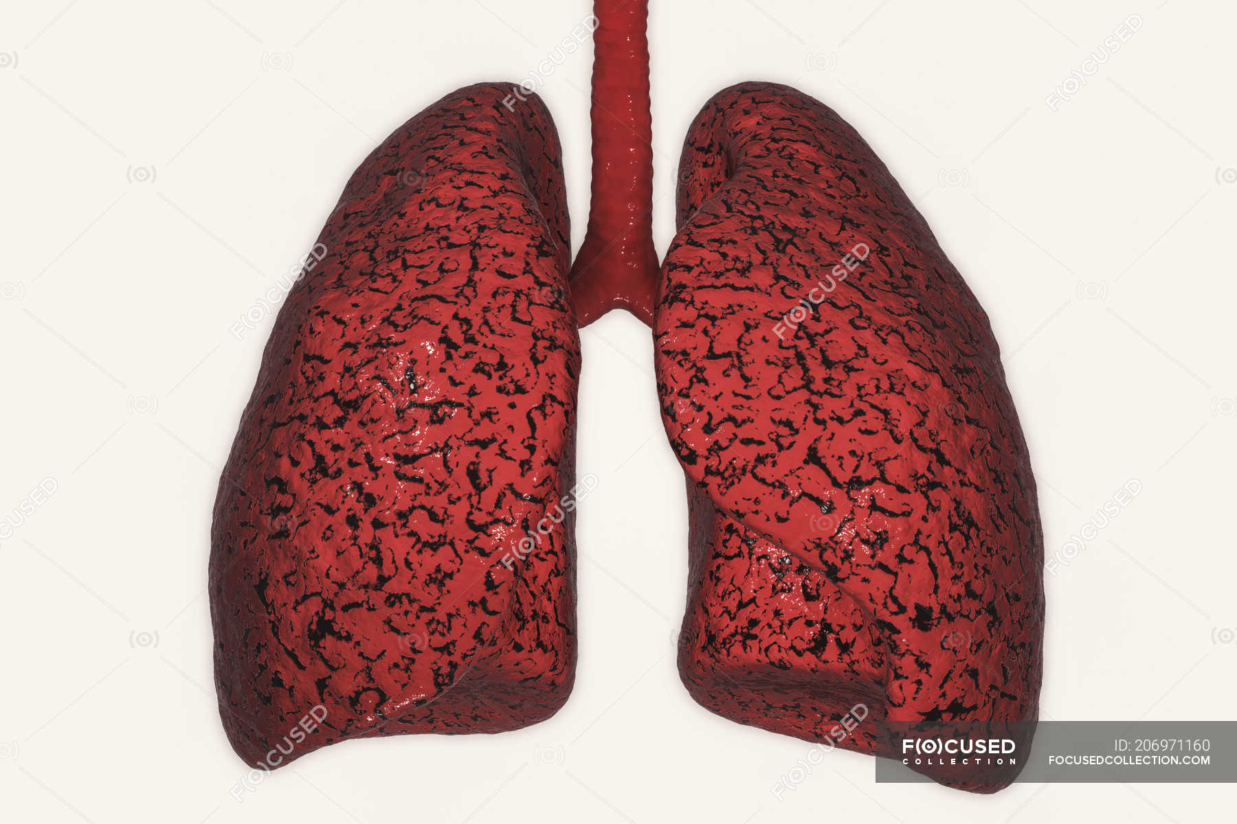 unhealthy human lung