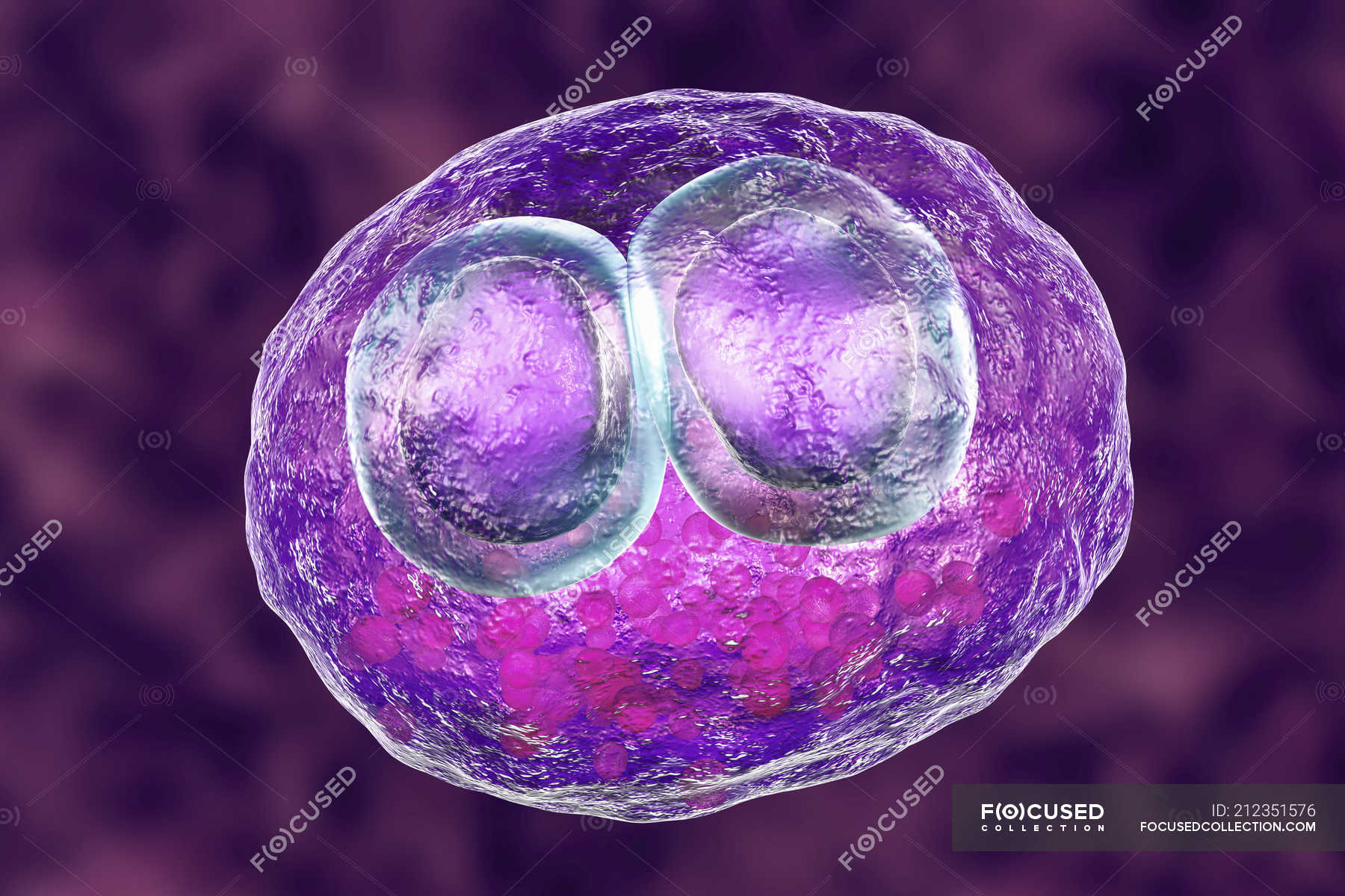 Digital artwork of human cell with cytomegalic inclusion disease symptom of  cytomegalovirus infection. — condition, lung infection - Stock Photo |  #212351576