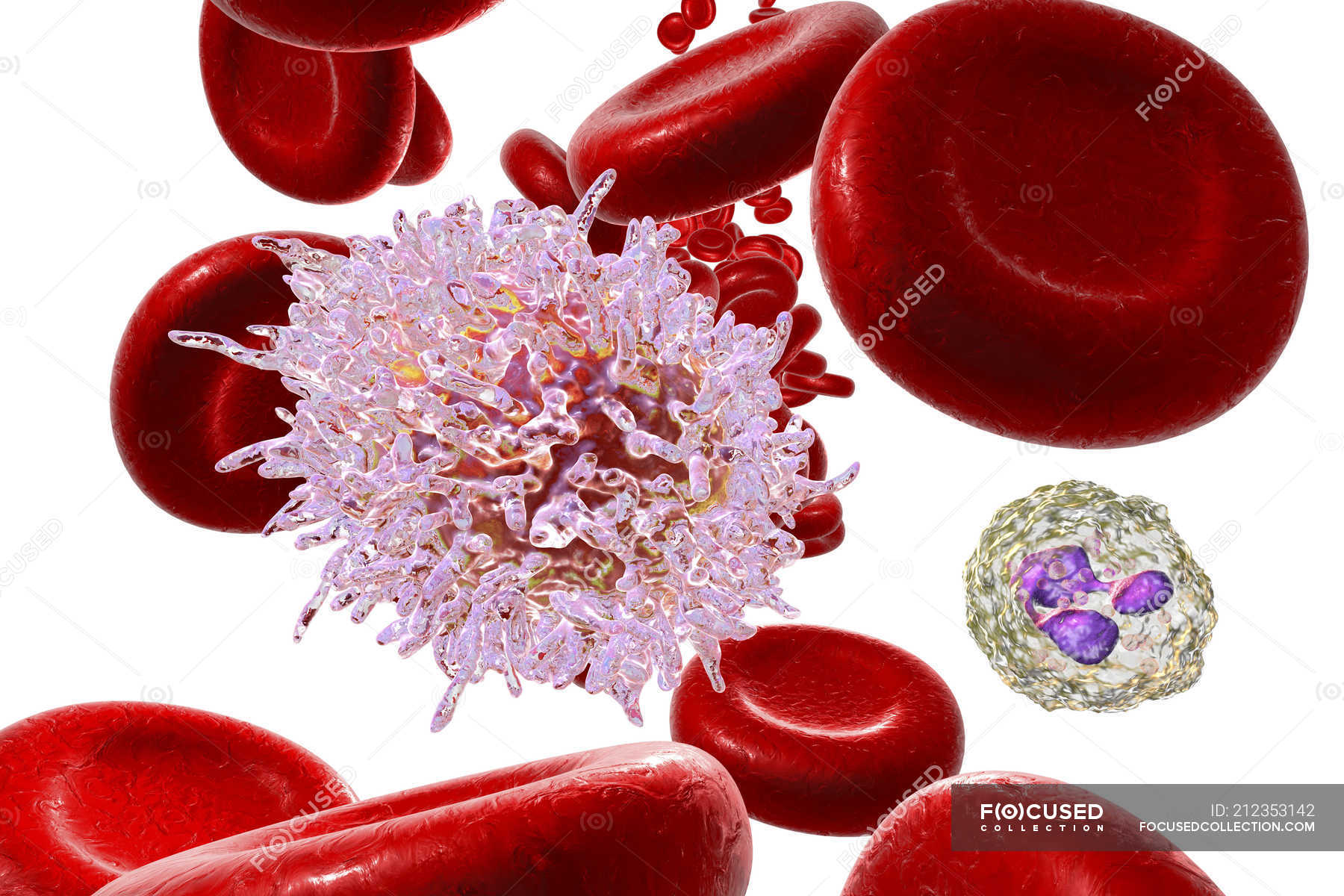 digital-illustration-of-abnormal-blood-cells-infected-by-hairy-cell