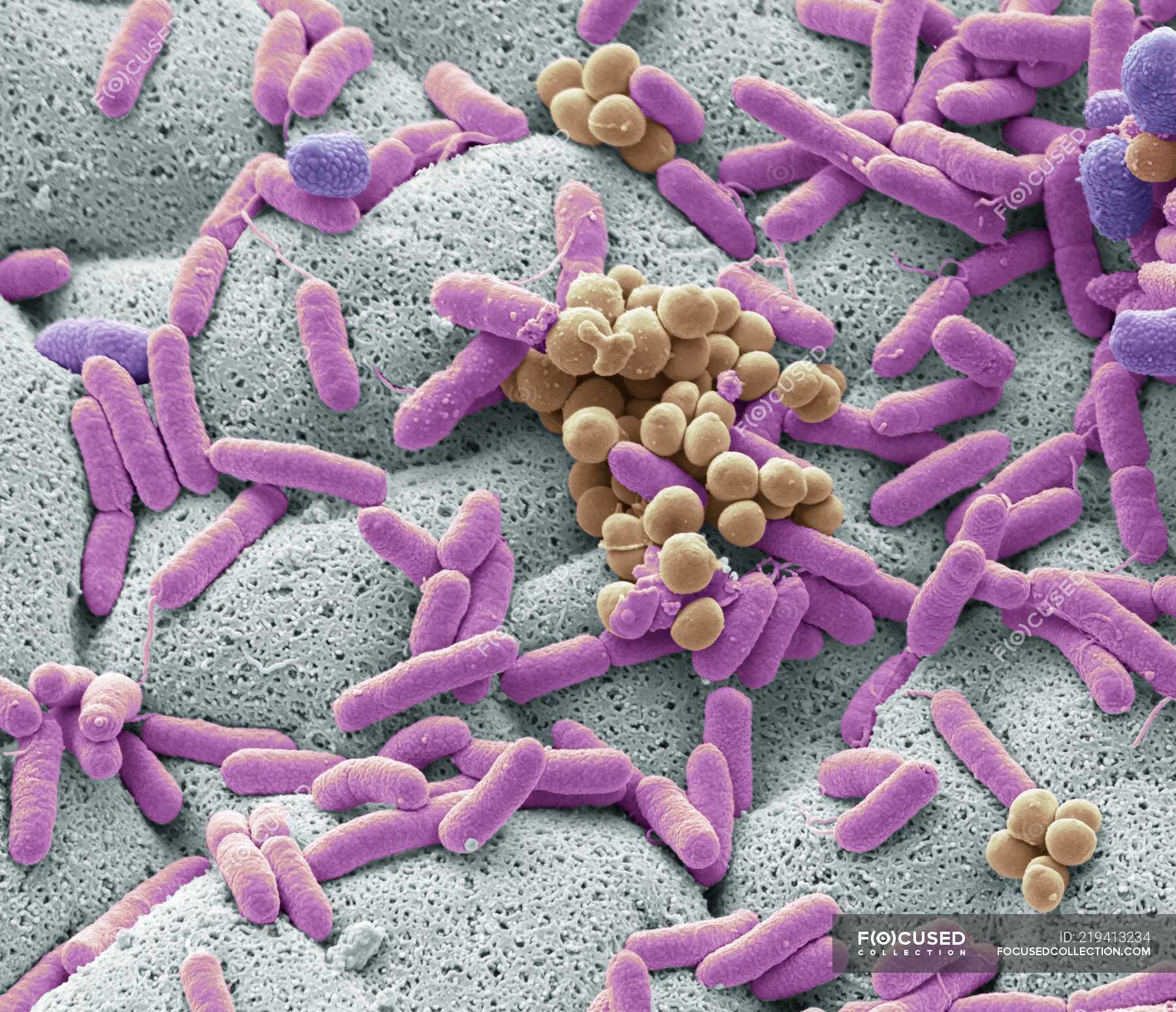 Scanning Electron Microscope Images Bacteria