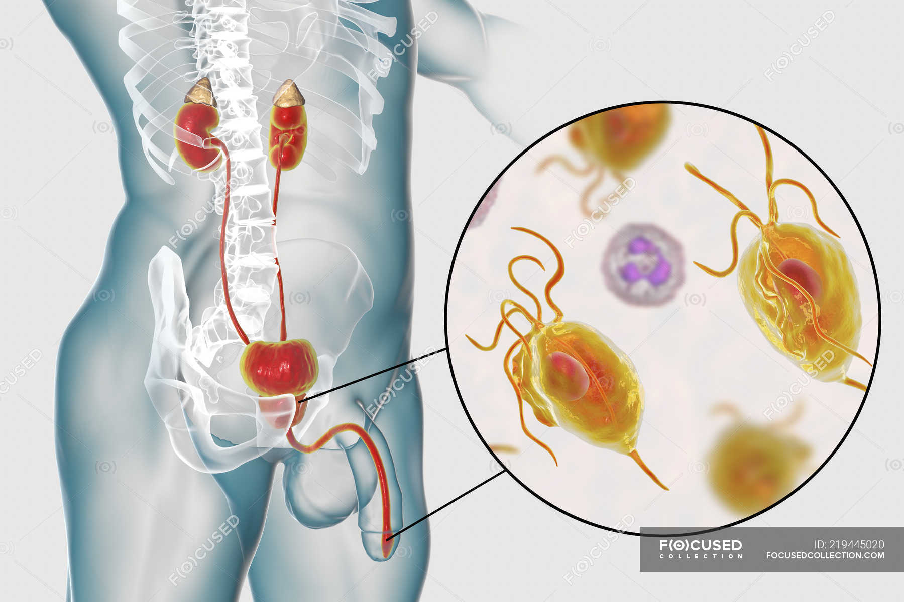 Illustration Of Male Urinary System And Parasitic Trichomonas Vaginalis Causing Trichomoniasis