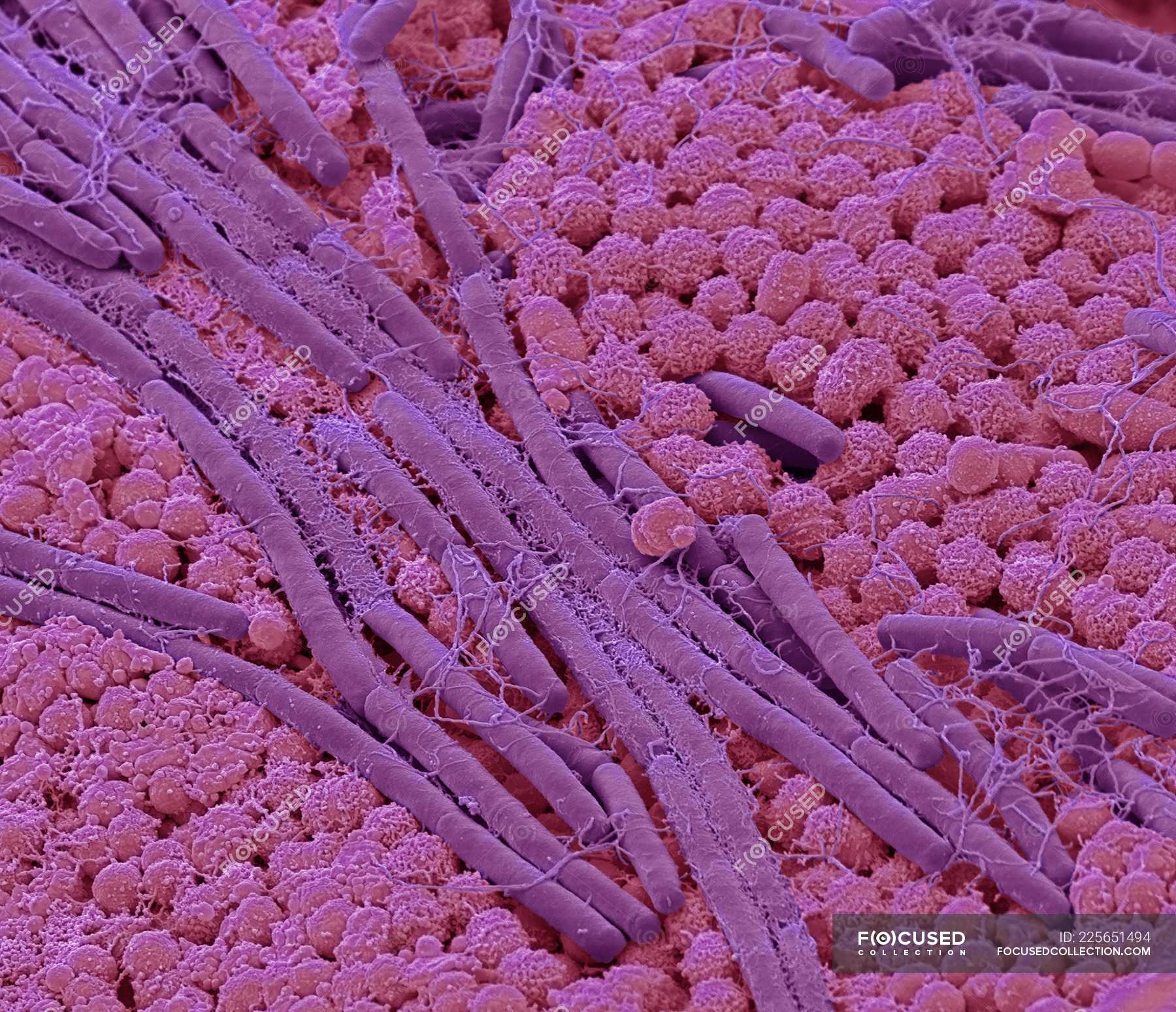 Микрофотографии бактерий