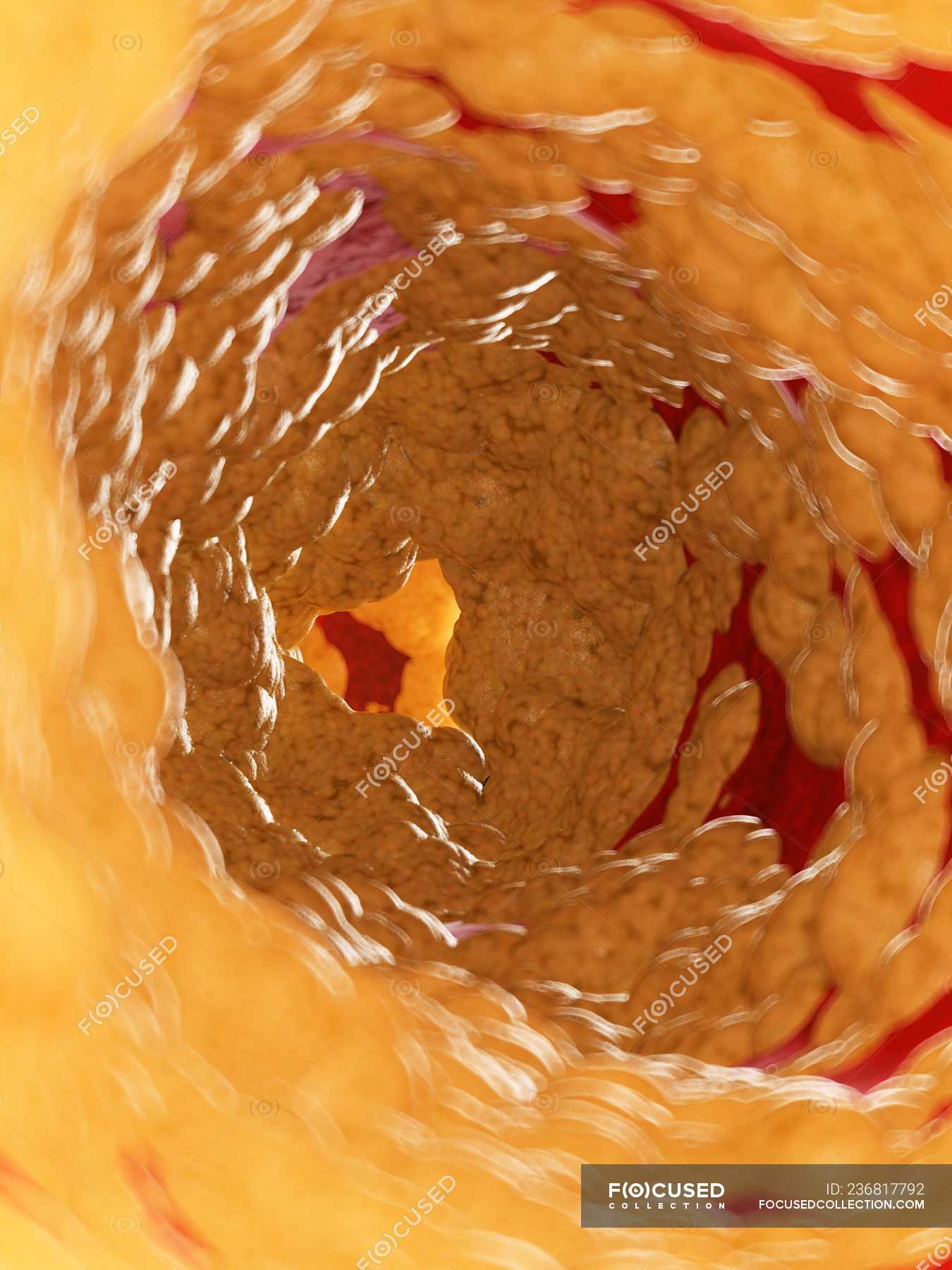 Как выглядит жир змей. Как выглядитьчеовеческий жир. Килограмм человеческого жира. Как выглядит человечески жыр. Как выглядит жир змей.