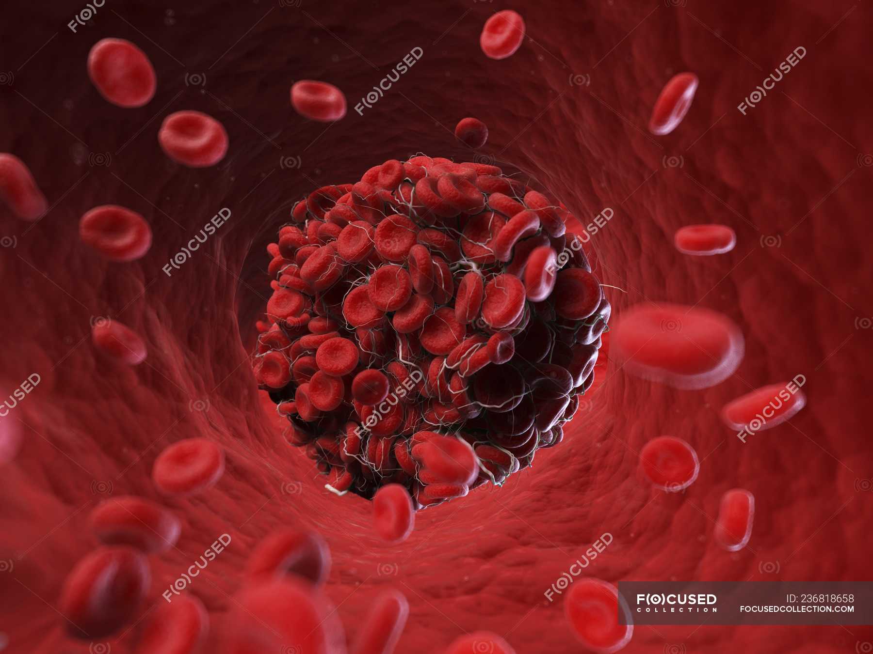 illustration-of-group-of-cells-in-blood-clot-vessel-3d-stock