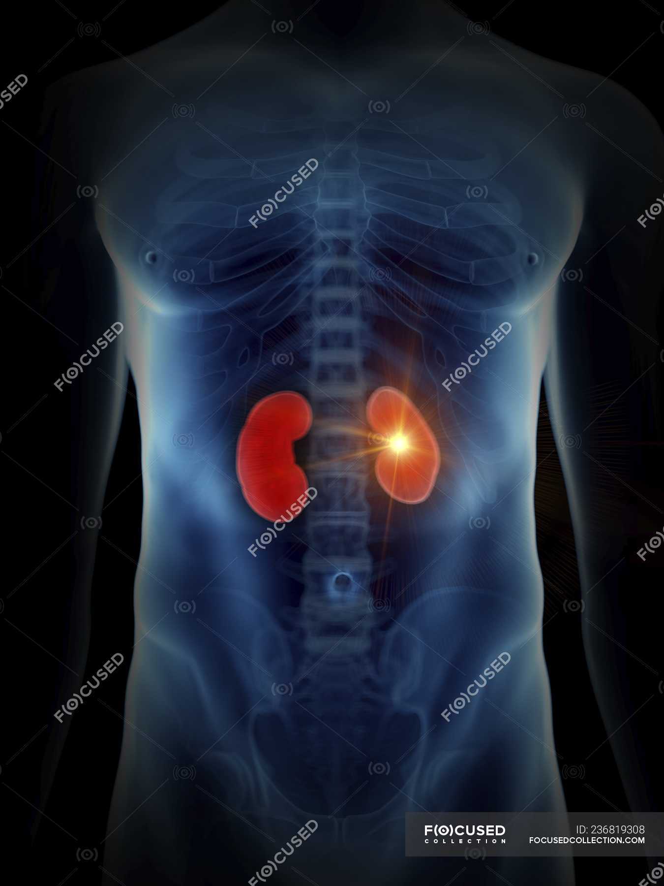Illustration of human silhouette with painful kidney. — biology ...