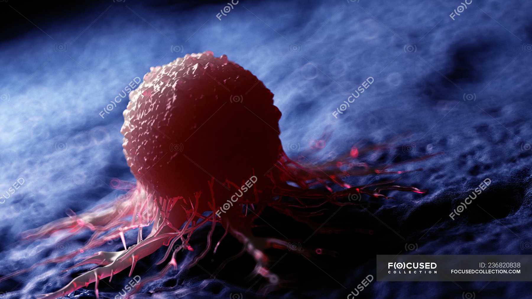 Митомицин и раковые клетки. Процесс который инициирует раковые клетки. Опухолевые клетки под микроскопом. Раковые клетки и здоровые. Строение злокачественной опухоли.