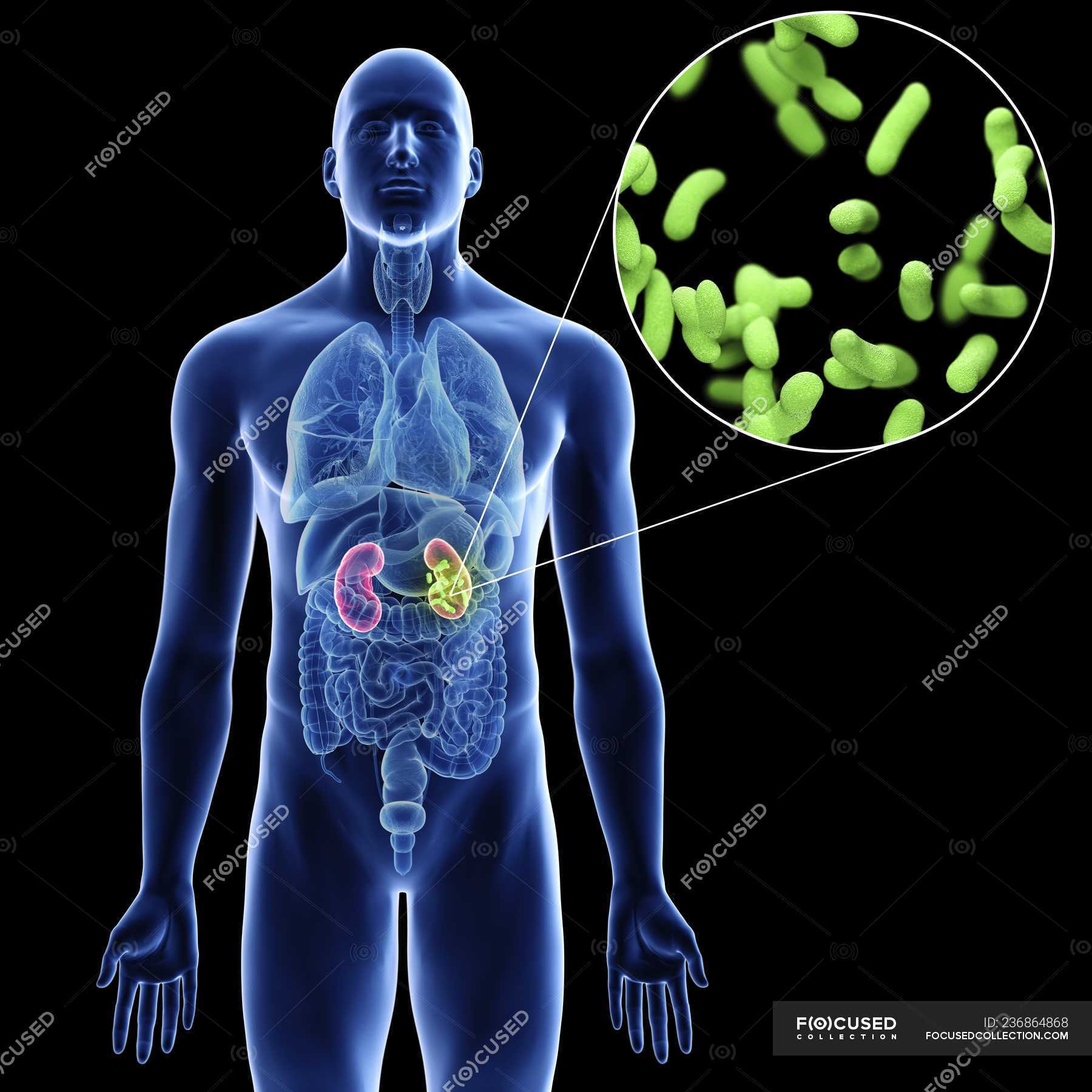 illustration-of-kidneys-and-close-up-of-infection-bacteria-in-male-body