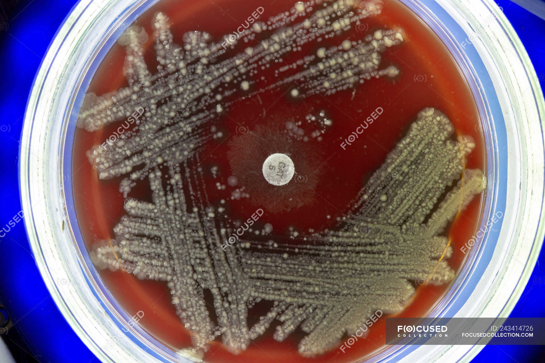 Колонии в чашке петри. Serratia marcescens на средах. Энтерококки на чашке Петри. Колонии грибов в чашке Петри красные. Донные колонии микроорганизмов.