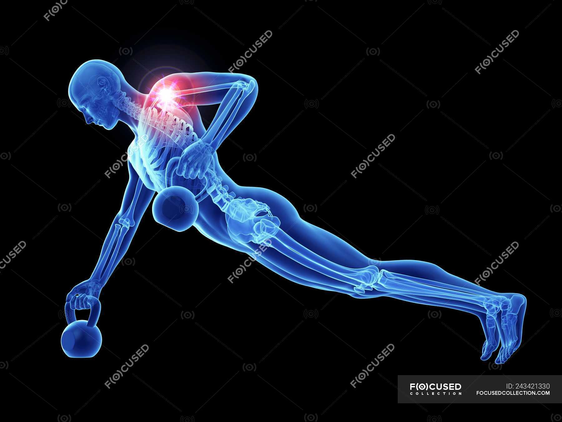 3d rendered illustration of male athlete with kettlebells with painful