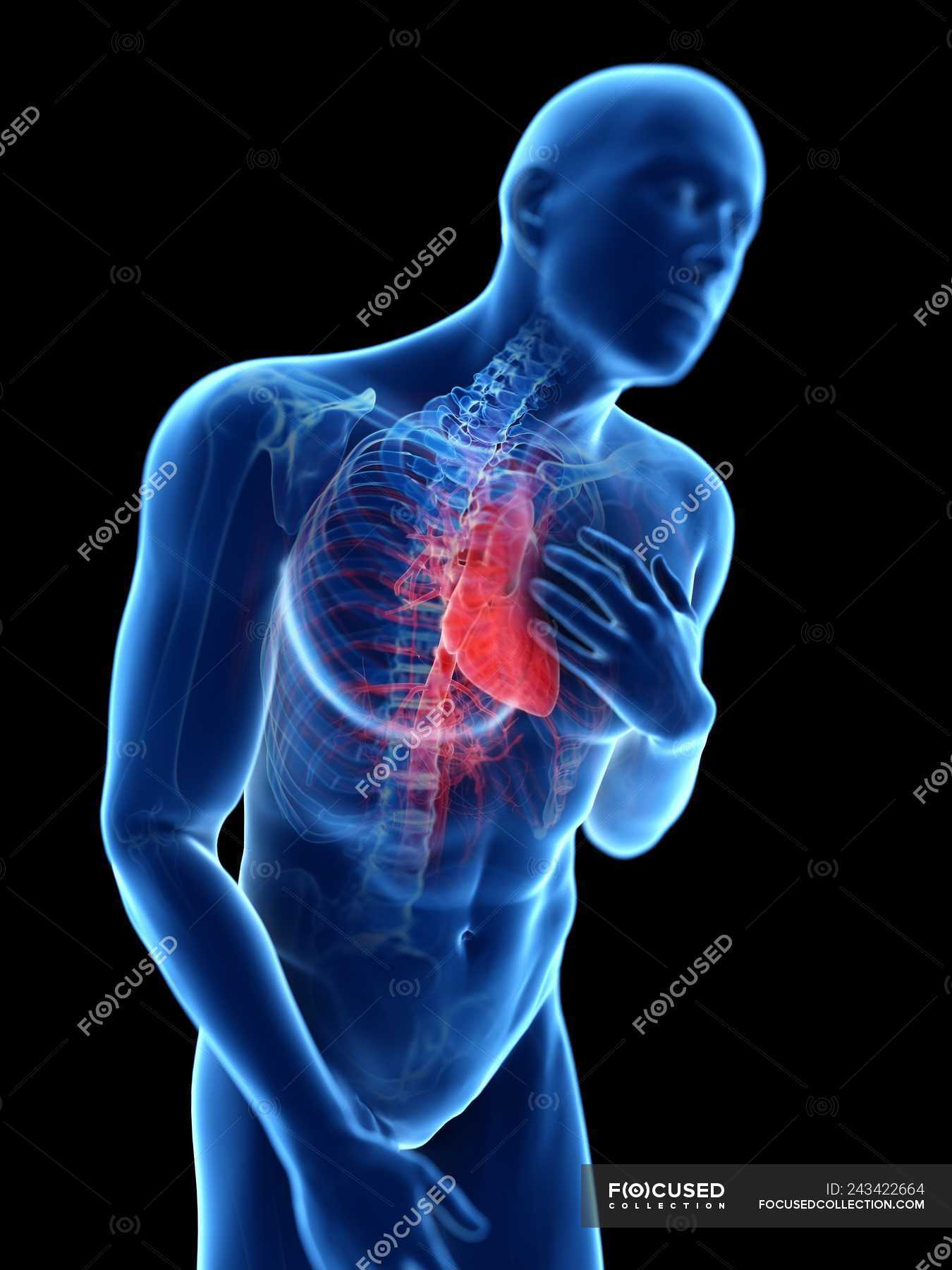 3d rendered illustration of blue silhouette of man with chest pain ...