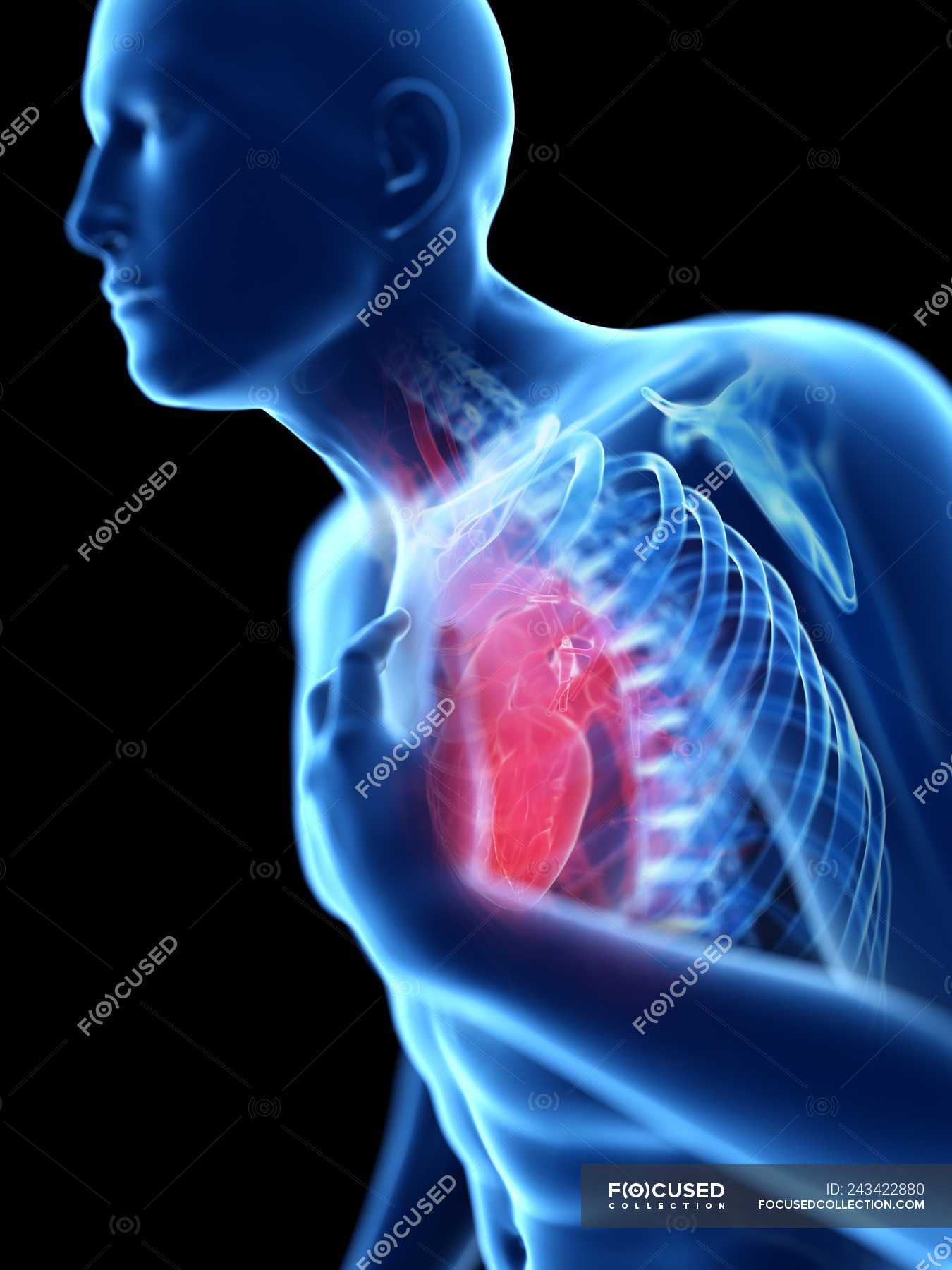 3d rendered illustration of blue silhouette of man with chest pain on ...