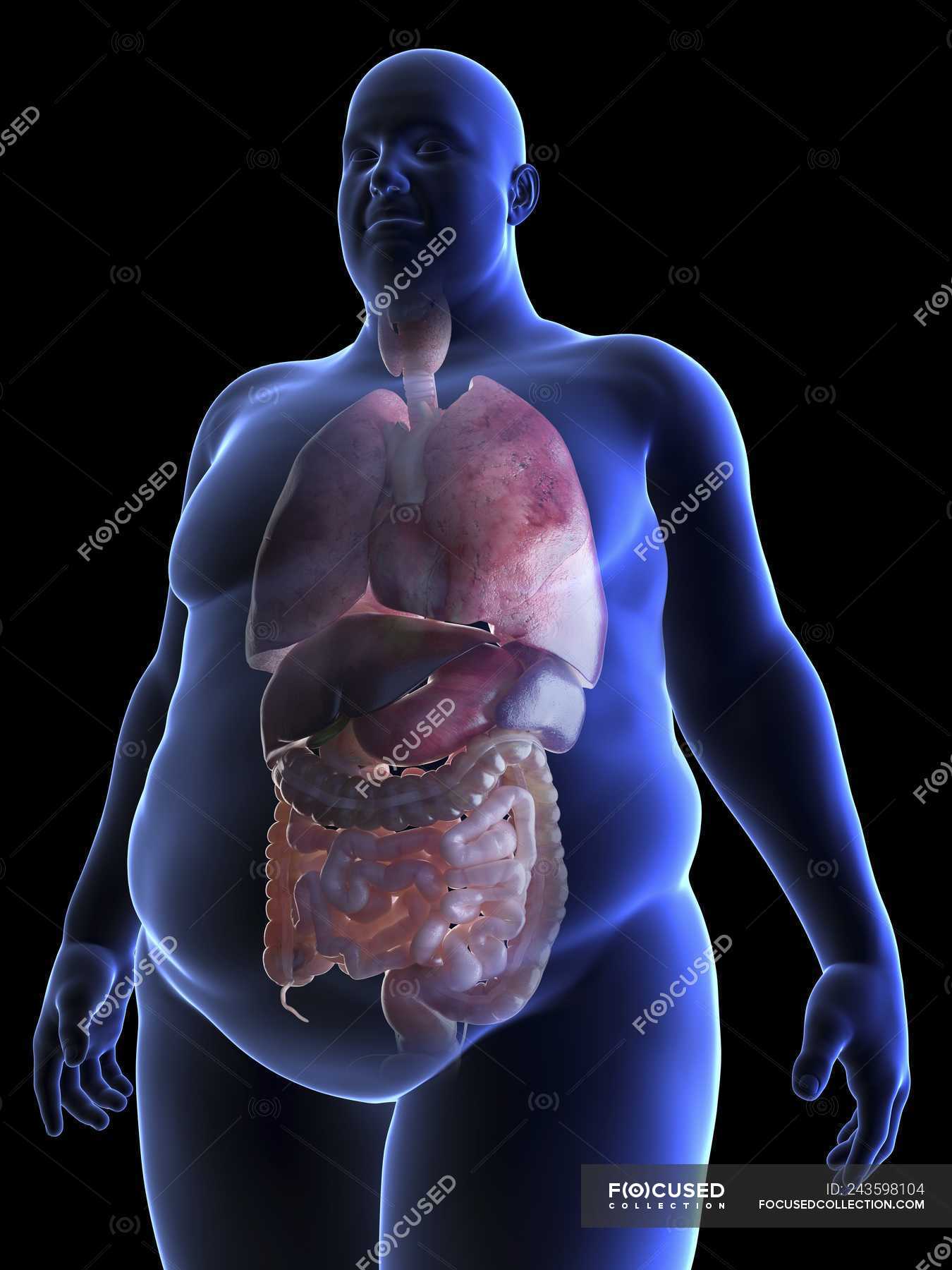 Толстый человек анатомия. Внутренние органы человека с ожирением. Толстый человек в разрезе. Анатомия человека с ожирением.