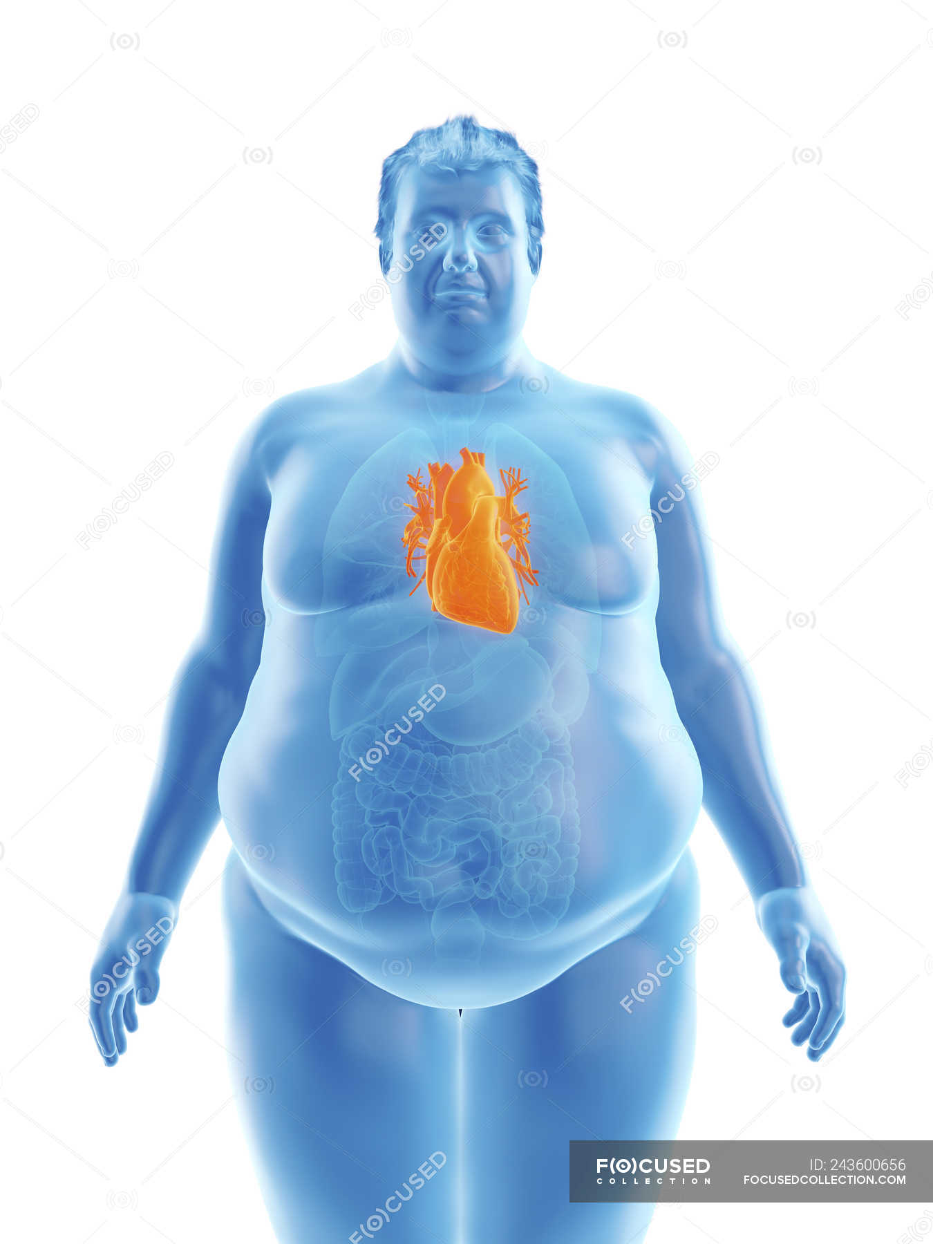 Печень 9 8 7. Анатомия человека с ожирением. Ожирение у легочных больных. Человек толстый пузырь.
