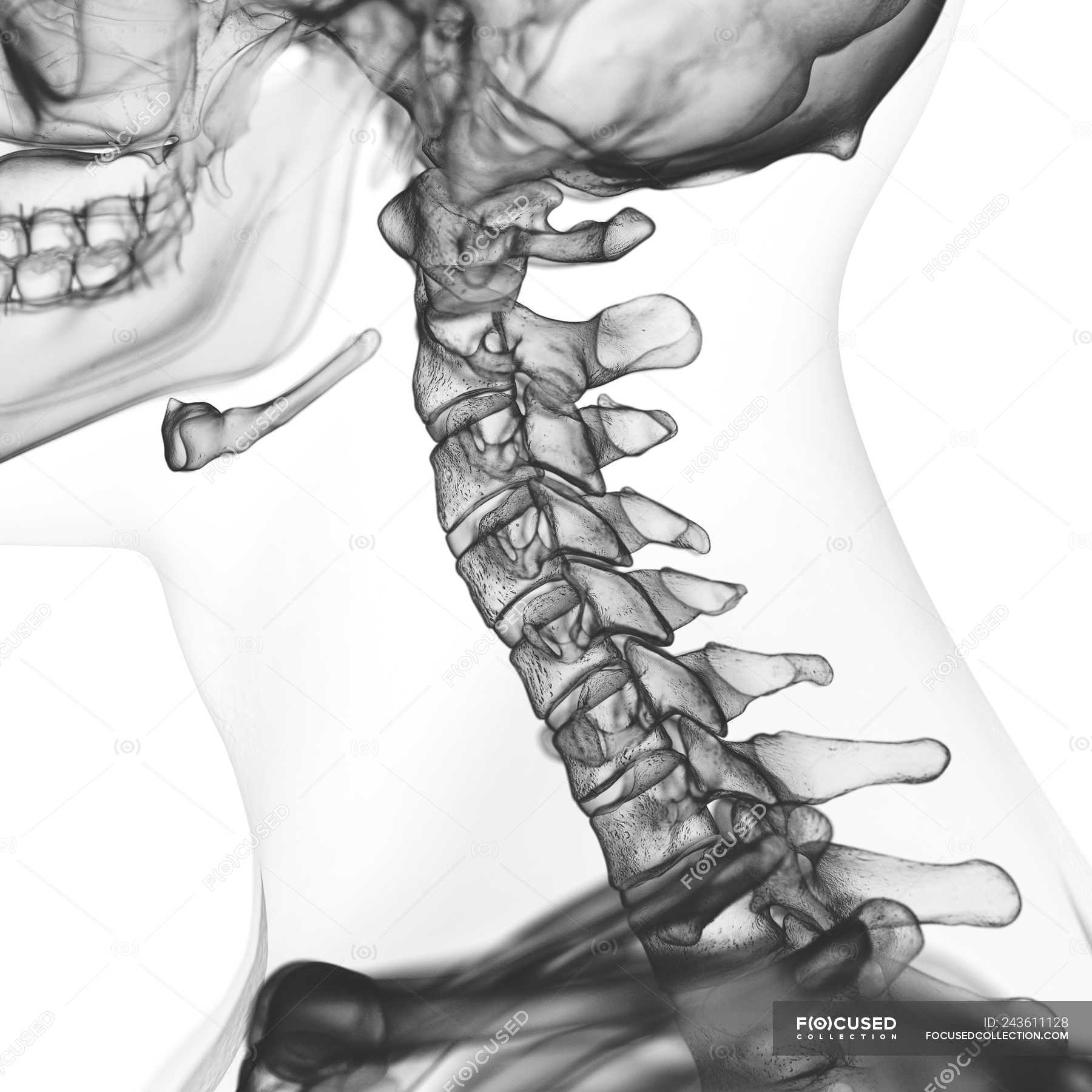 Шейный отдел кости скелета. Шейные позвонки скелет. Скелет шейного отдела позвоночника человека. Шейный отдел позвоночника анатомия. Скелет анатомия шейный позвонок.