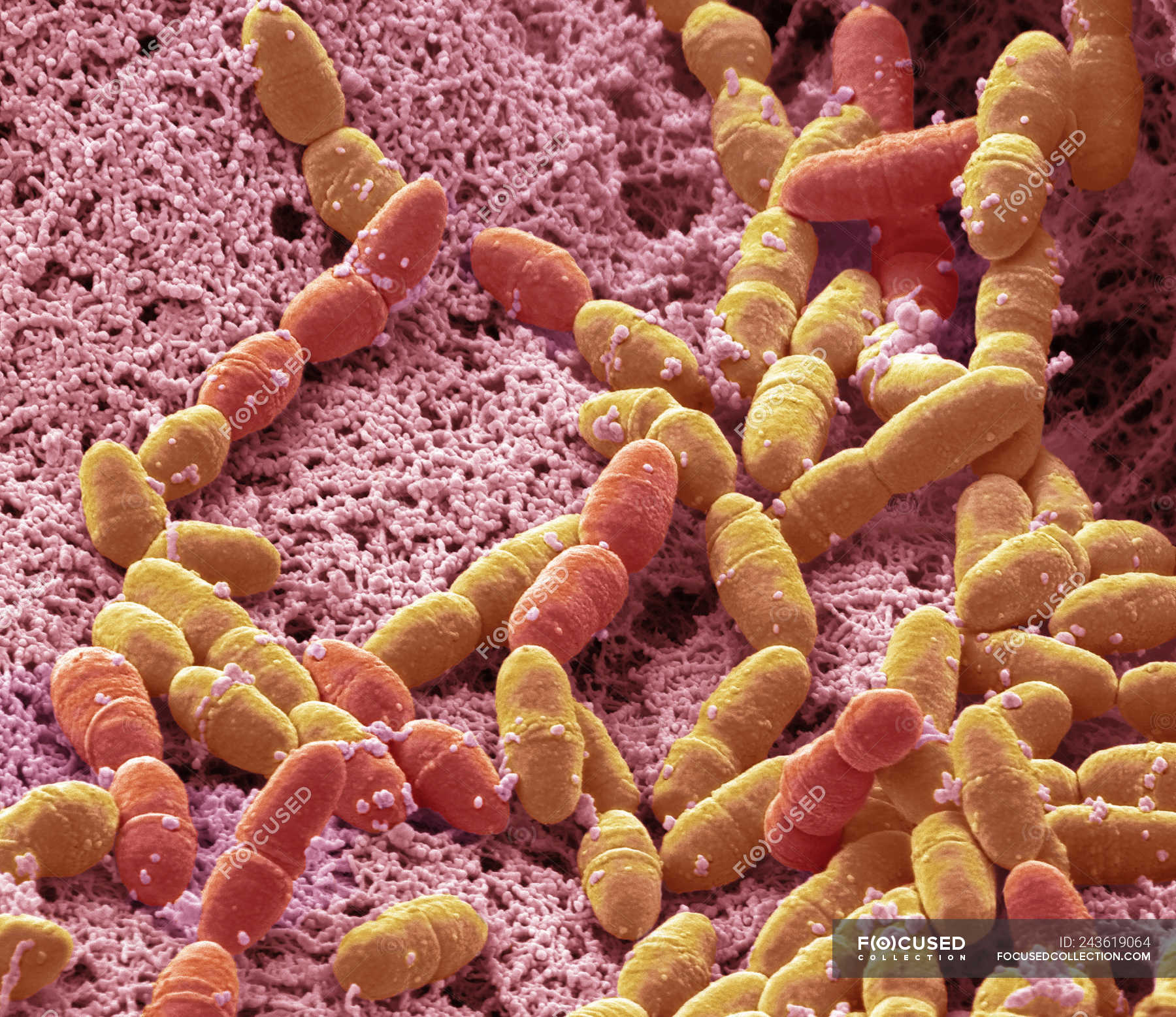 streptococcus pneumoniae electron micrograph