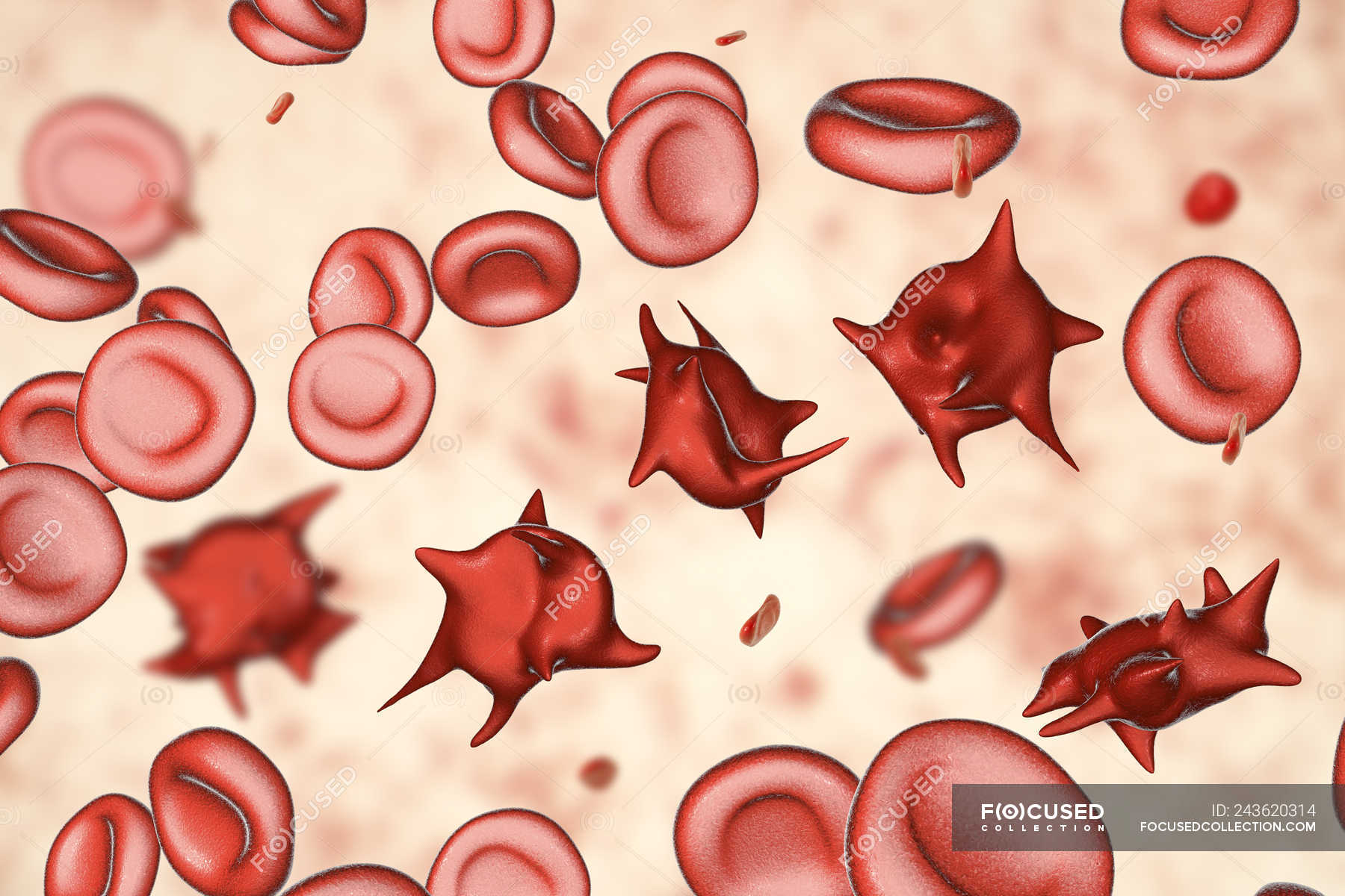 What Can Cause Abnormal Blood Cells