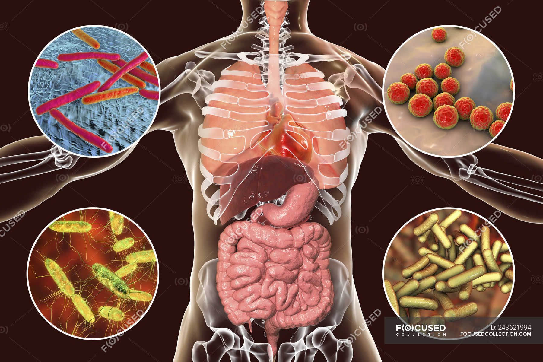 Digital illustration showing bacteria causing infections of respiratory