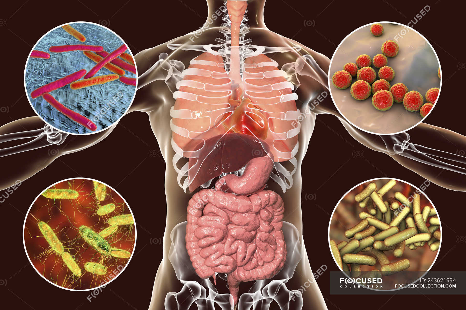 Digital Illustration Showing Bacteria Causing Infections Of Respiratory 