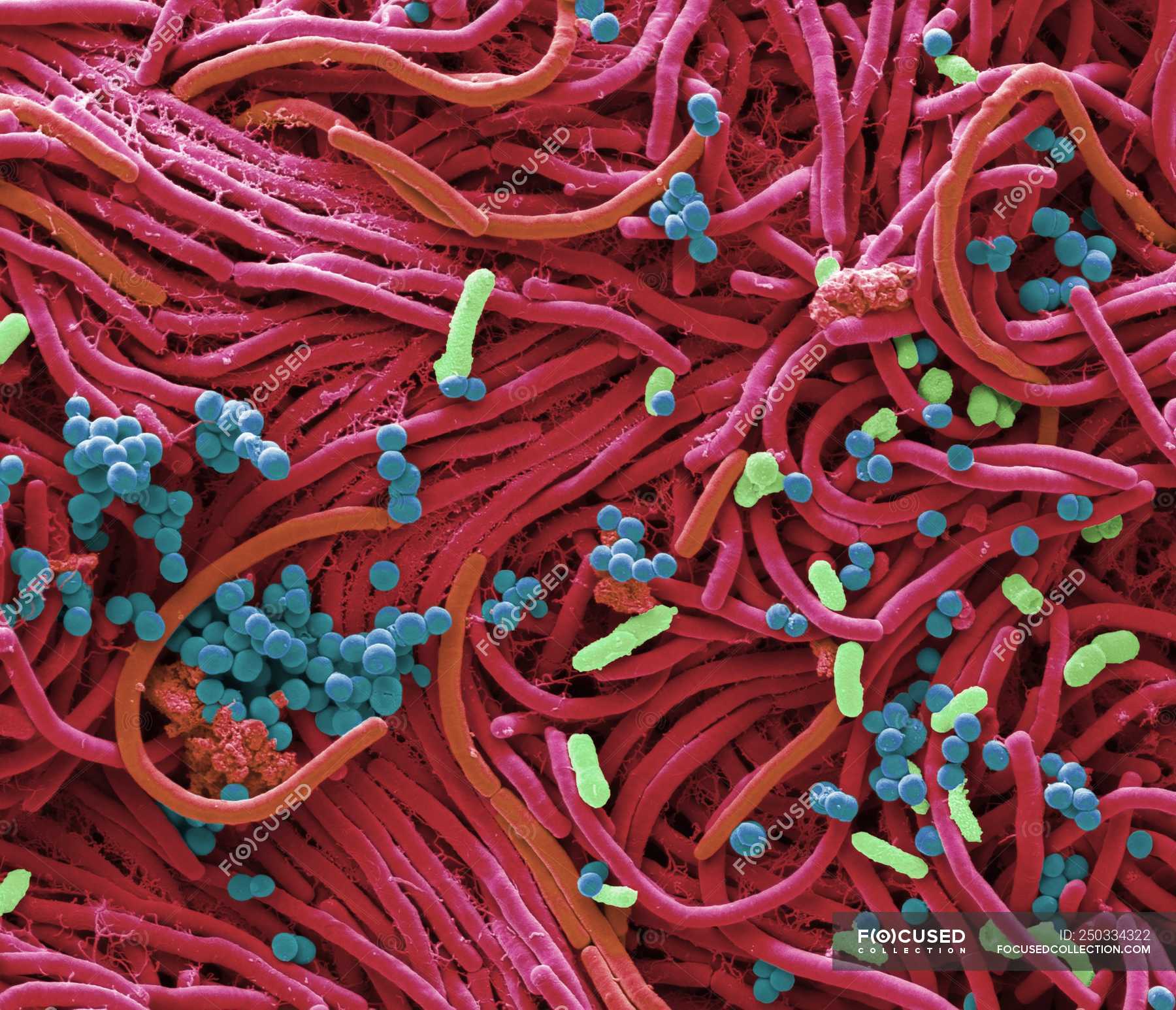 Coloured scanning electron micrograph of bacteria cultured from mobile ...