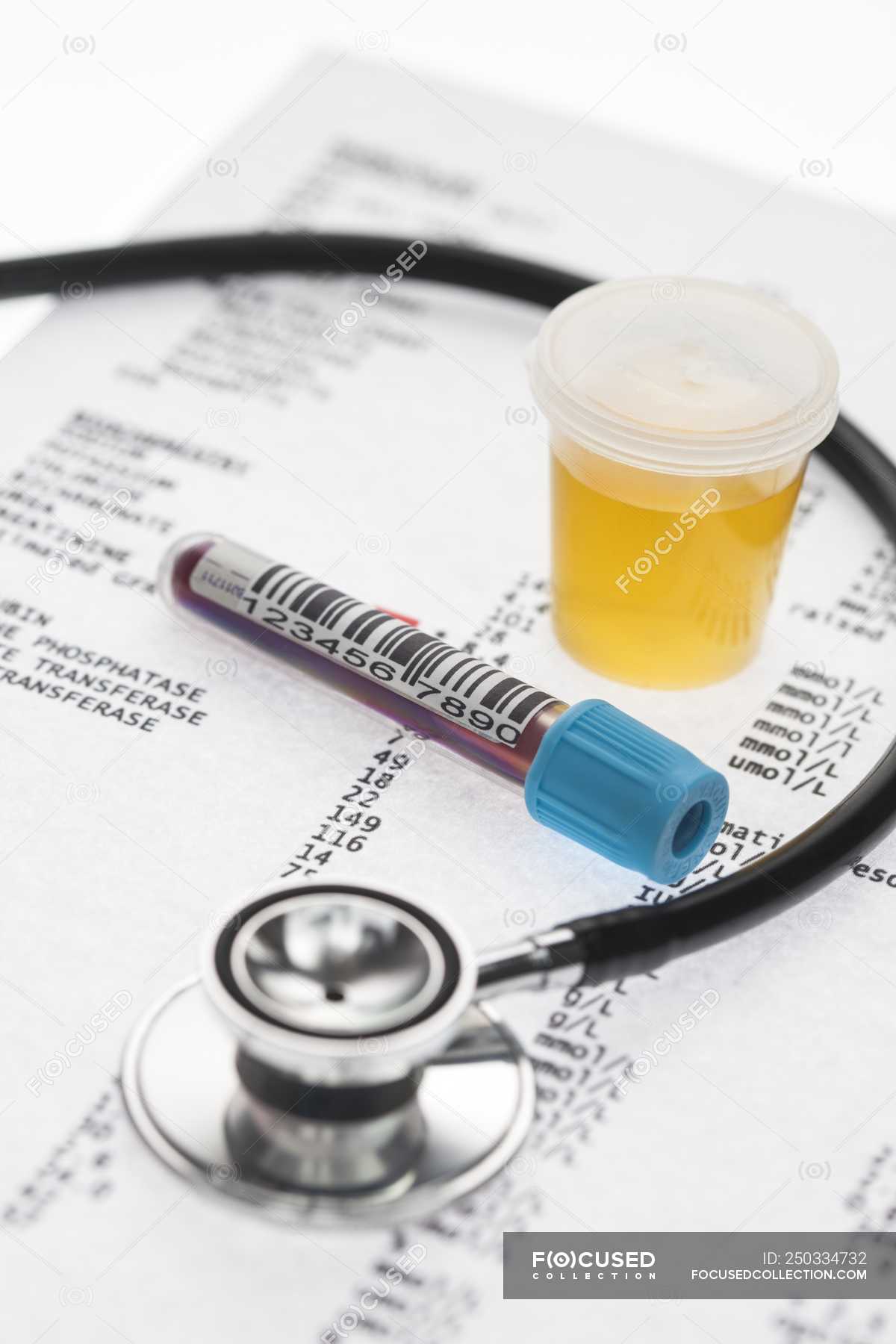 Medical checkup including blood and urine test samples and results. — stethoscope, urine sample