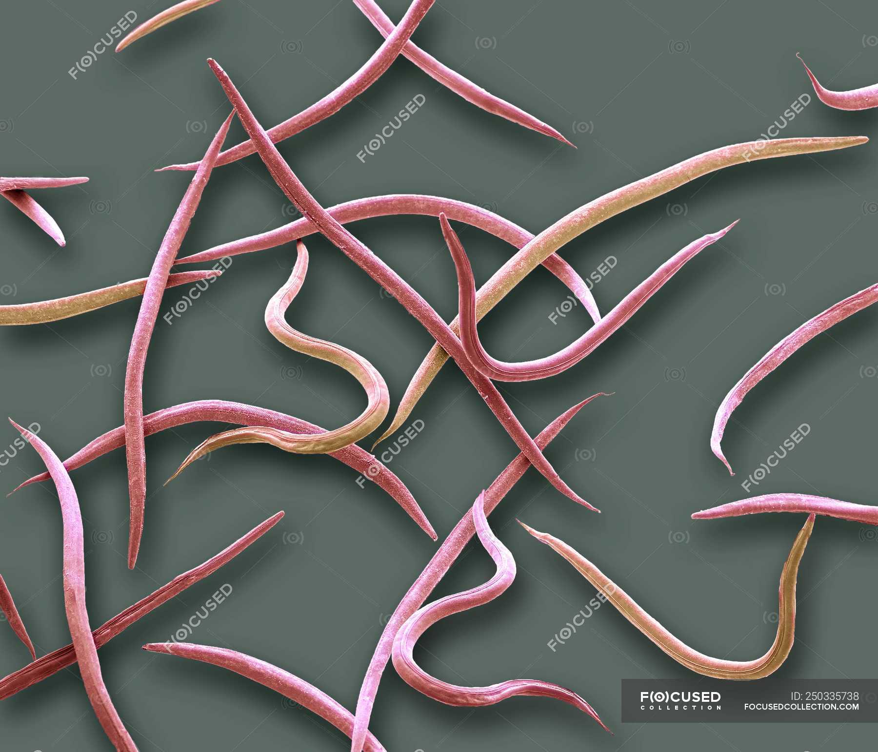 Coloured scanning electron micrograph of Phasmarhabditis hermaphrodita ...