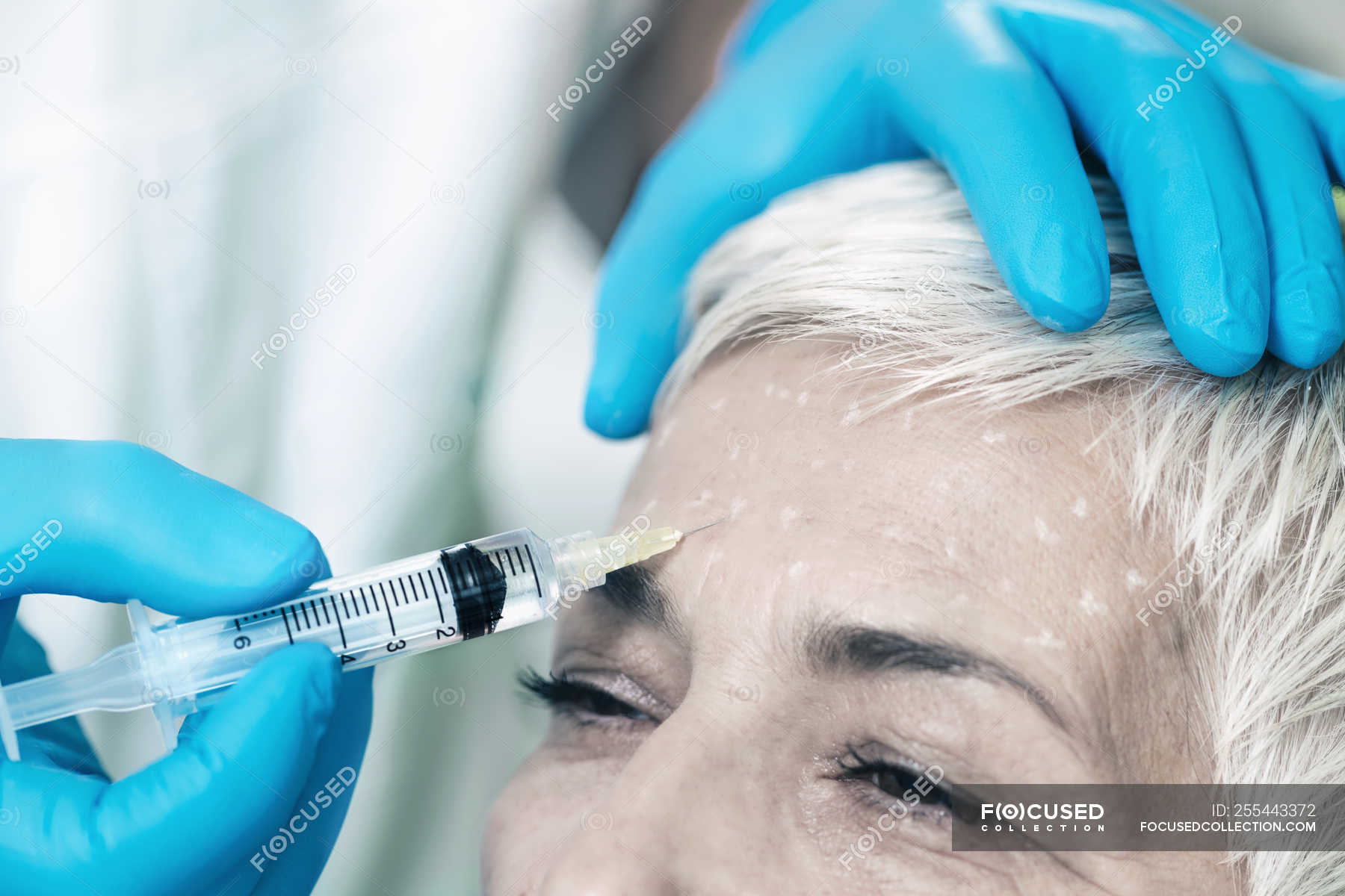 Mature Woman Receiving Botox Injection In Forehead In Cosmetology Clinic — Beauty Treatment 