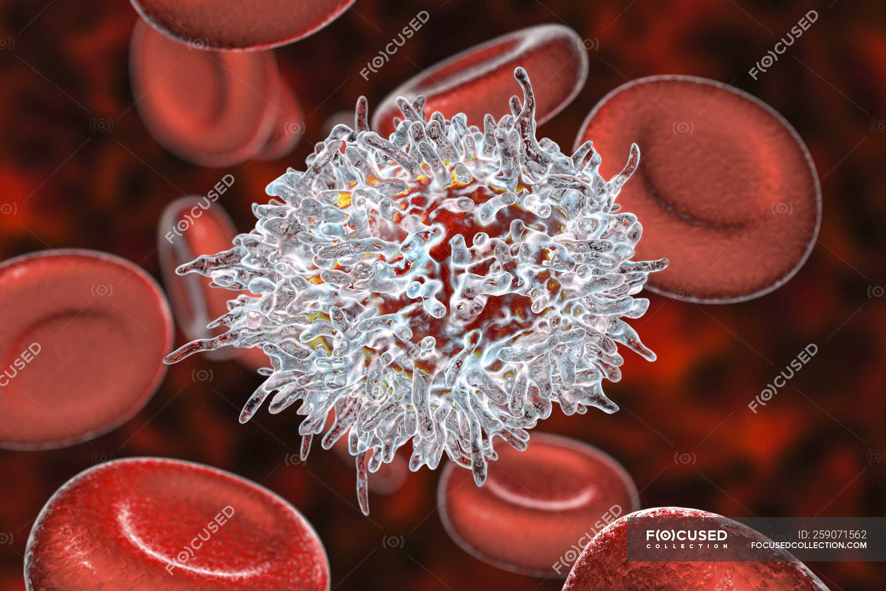 Digital Illustration Of Abnormal White Blood Cells B Lymphocytes While Hairy Cell Leukaemia B