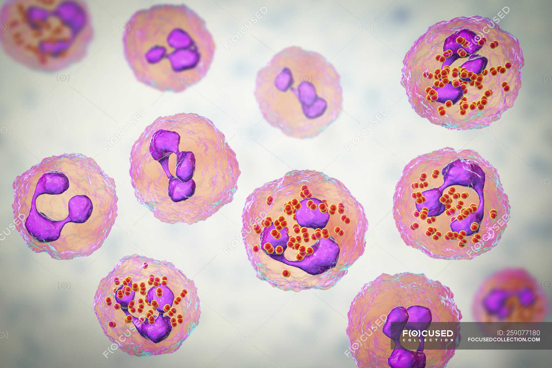 Digital illustration of cerebrospinal fluid and neutrophils with ...