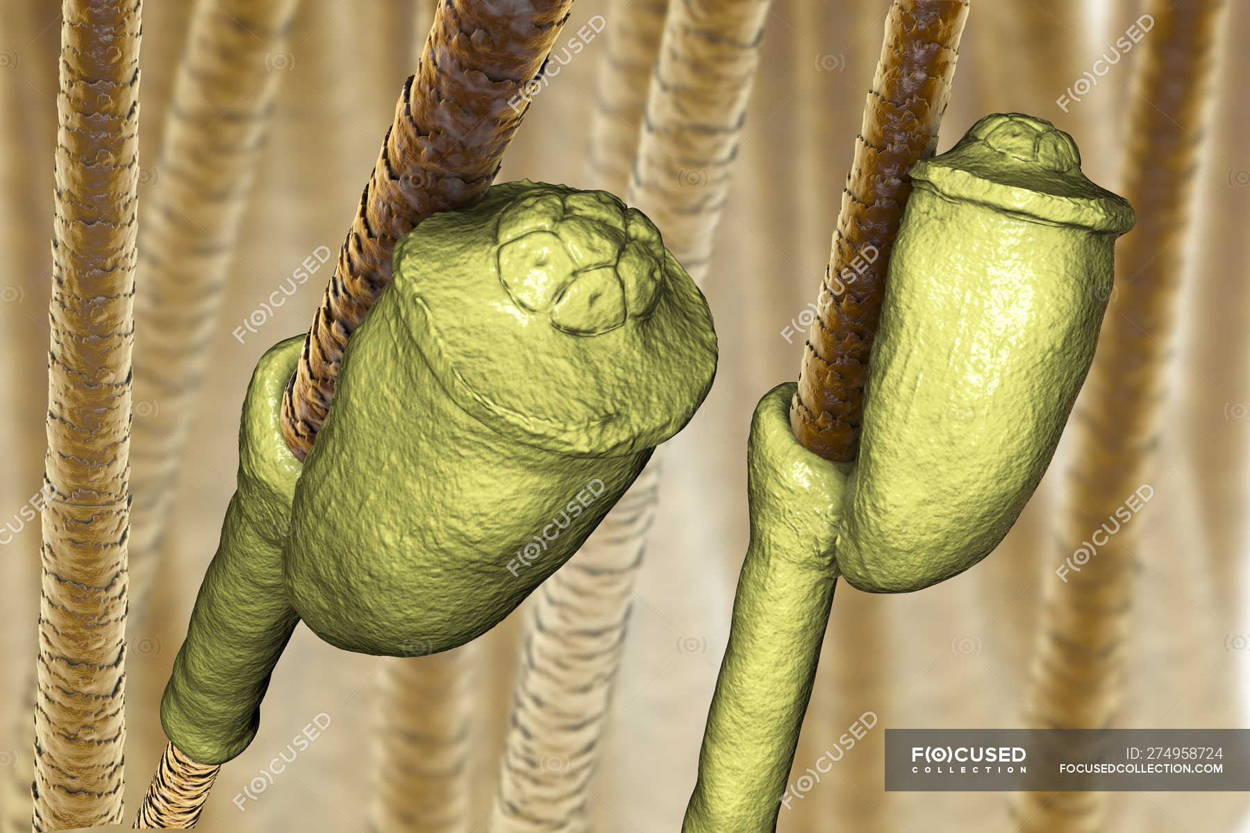 Digital Illustration Of Nits Eggs Of Human Head Louse Attached To