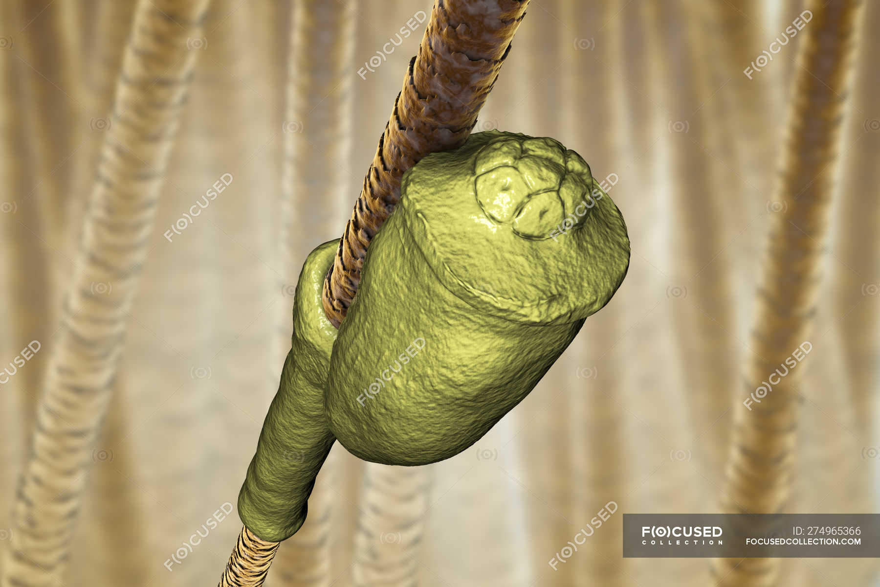 Digital Illustration Of Nit Egg Of Human Head Louse Attached To