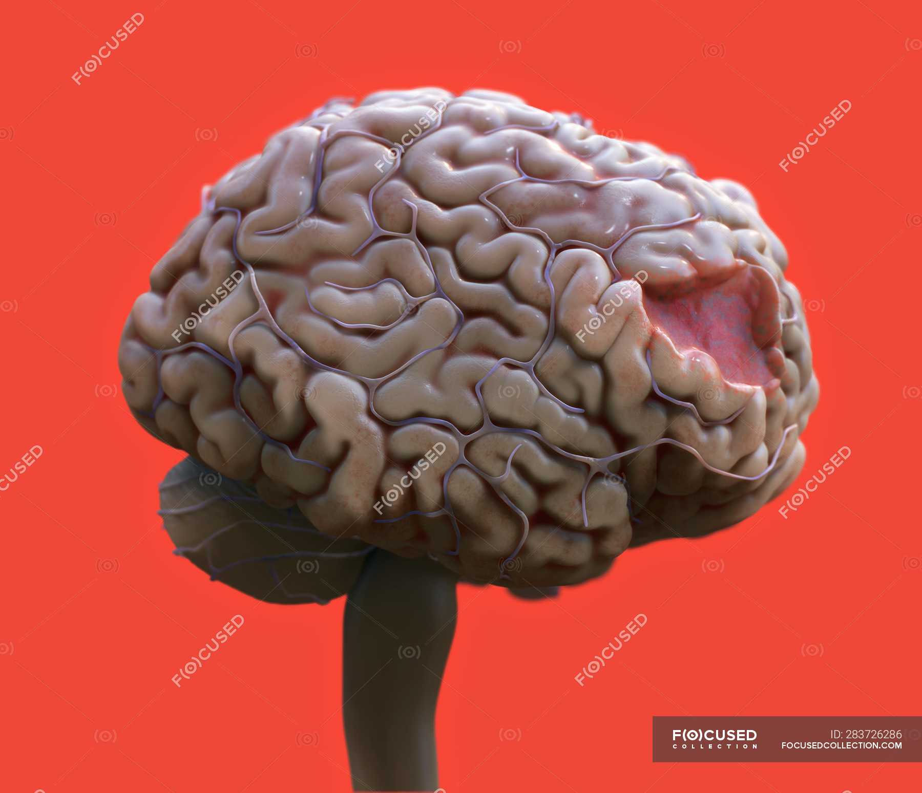 Brain 80